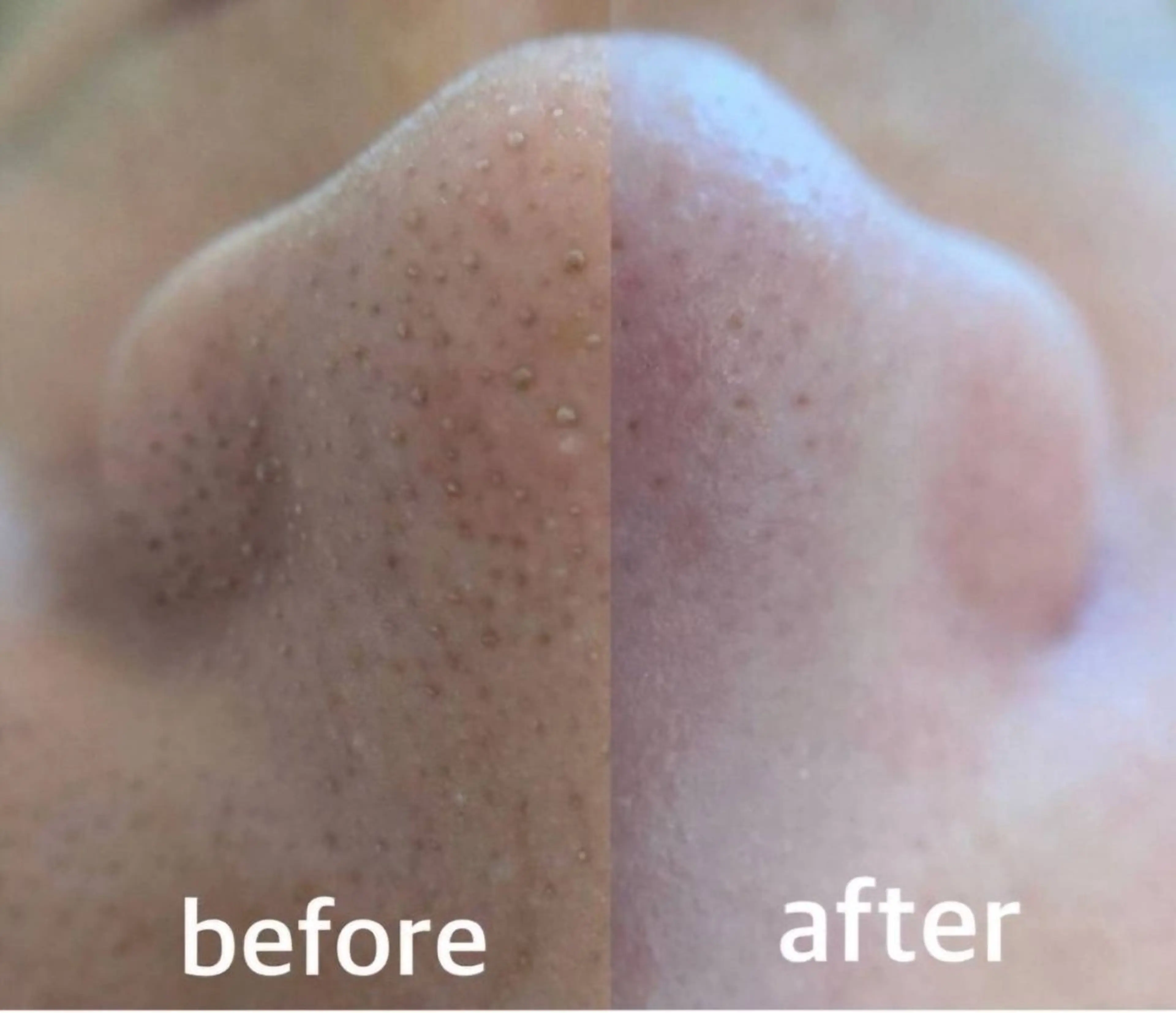 ADDICT中目黒店所属・毛穴洗浄/毛穴ケア 🌿中目黒🌿のエステ・リラクイメージ