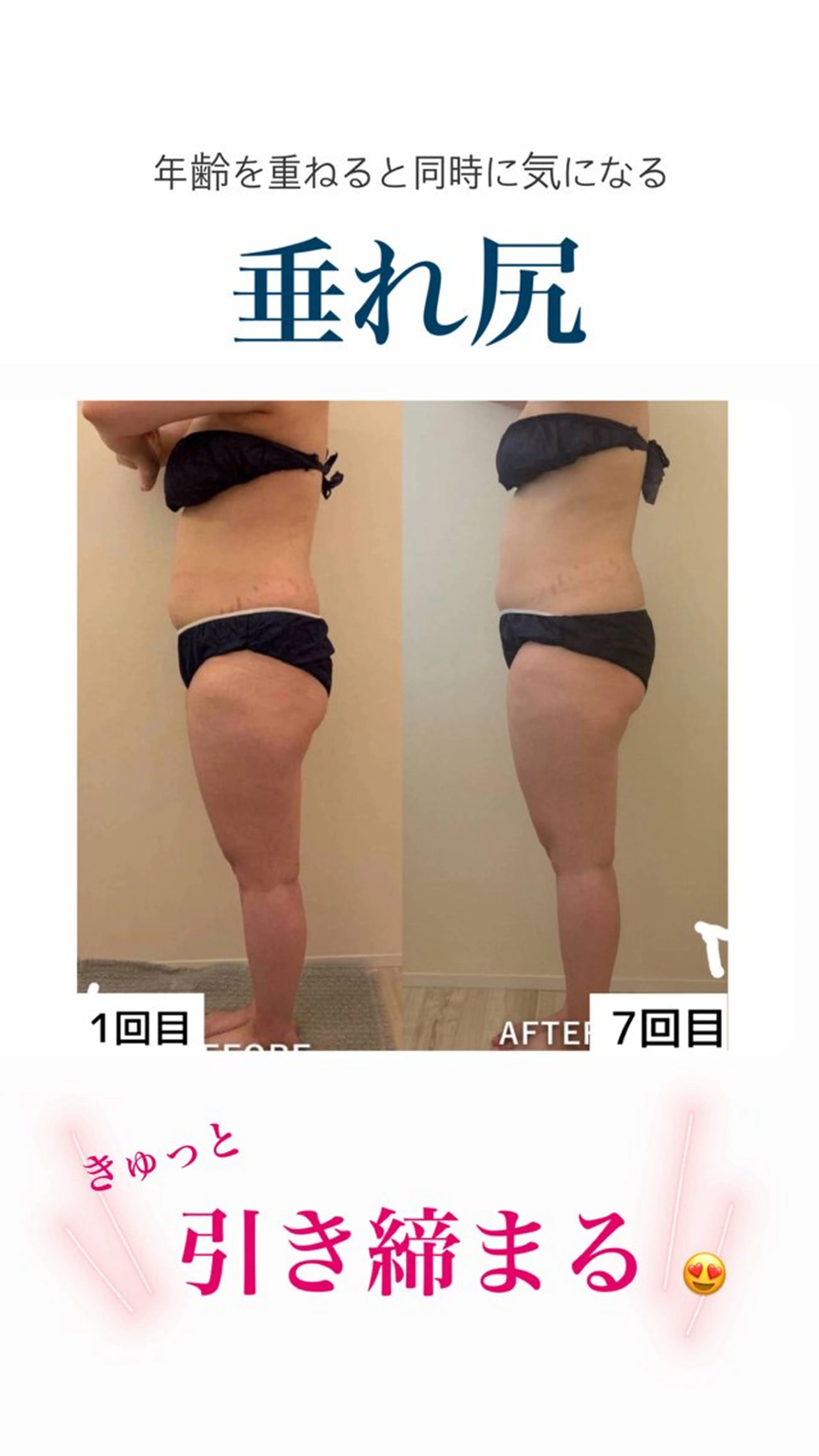 産後ダイエット−9㎏ Pourvous結衣のエステ・リラクイメージ