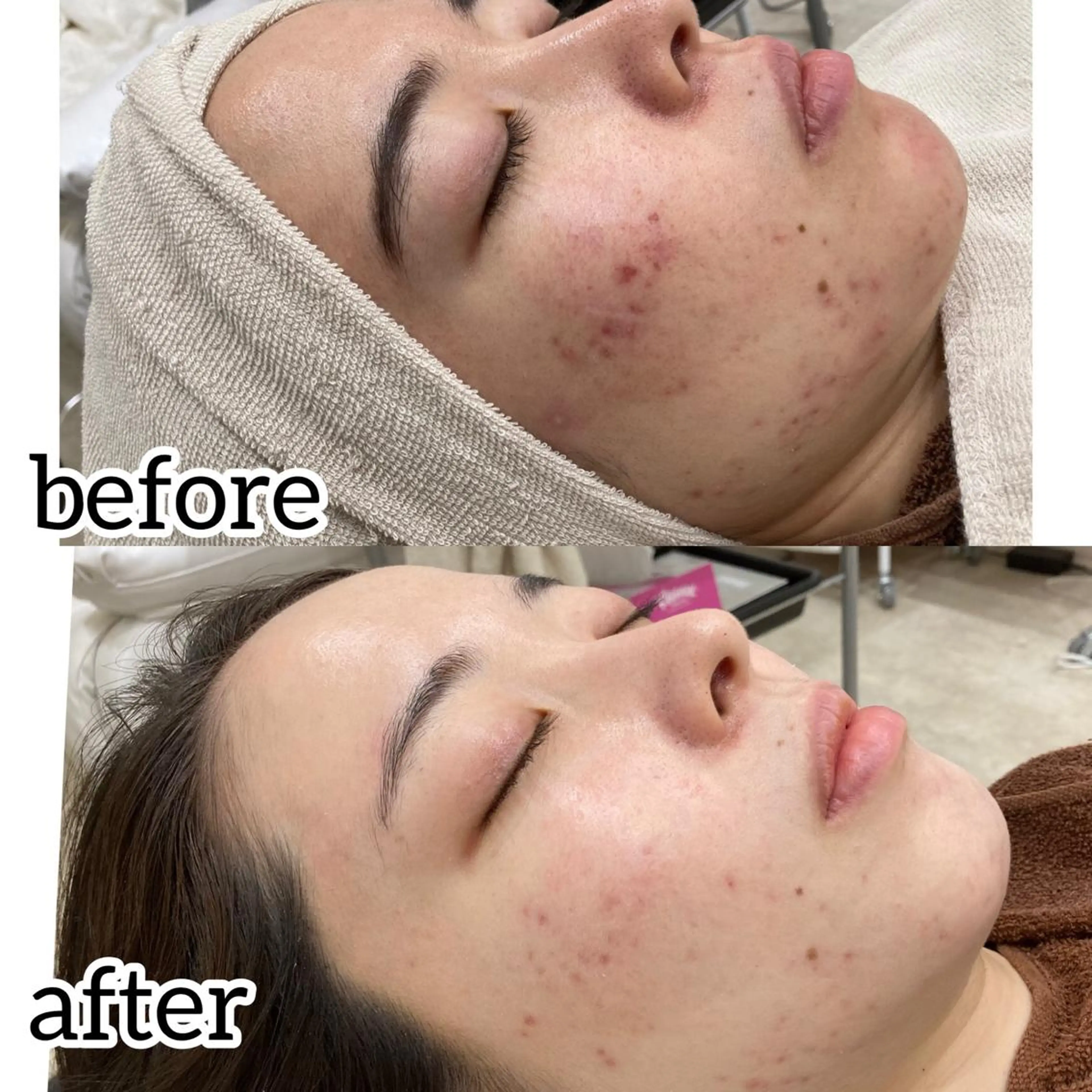 laluna saki...のその他イメージ