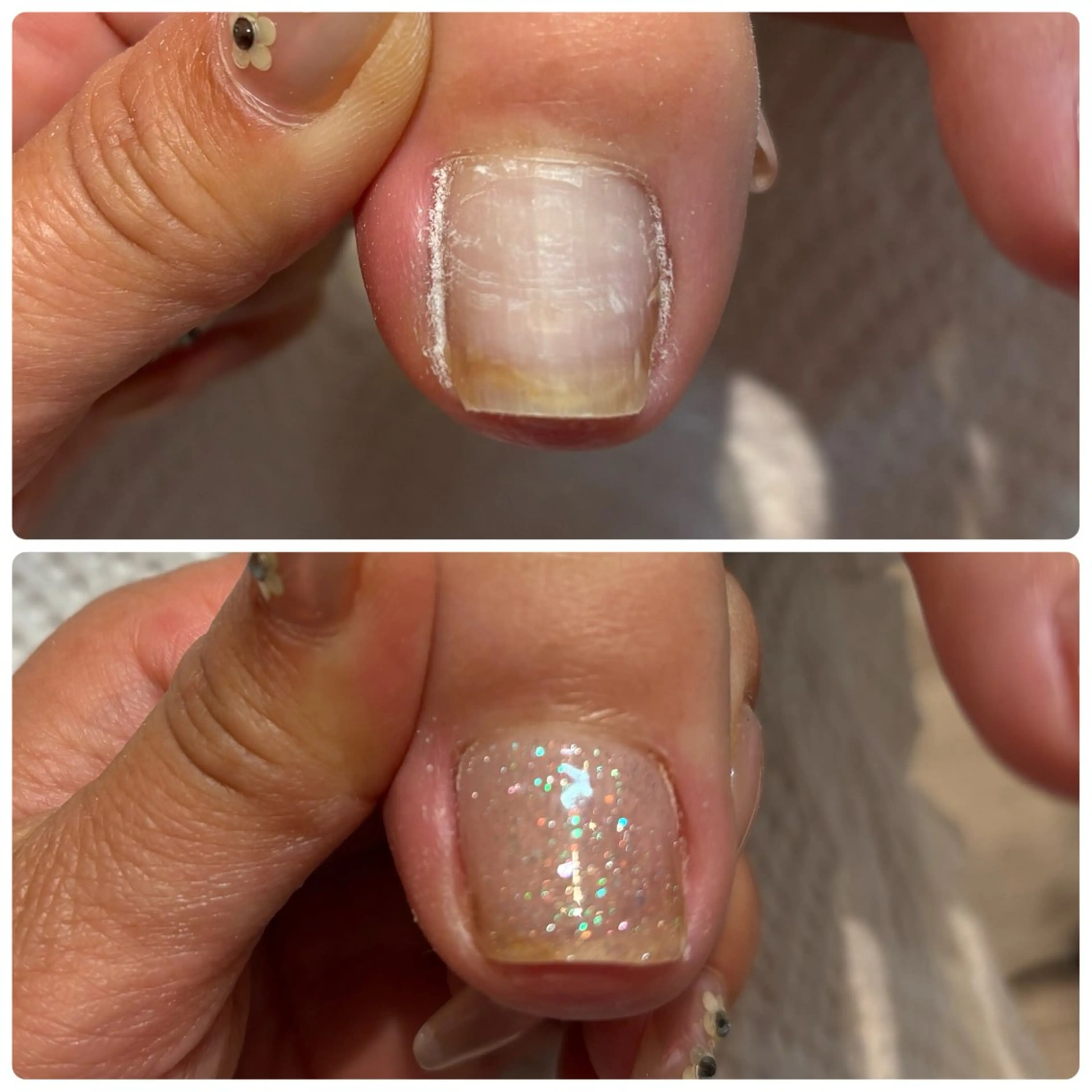 ネイル フットネイル Bibinail ☆namiのネイルデザイン