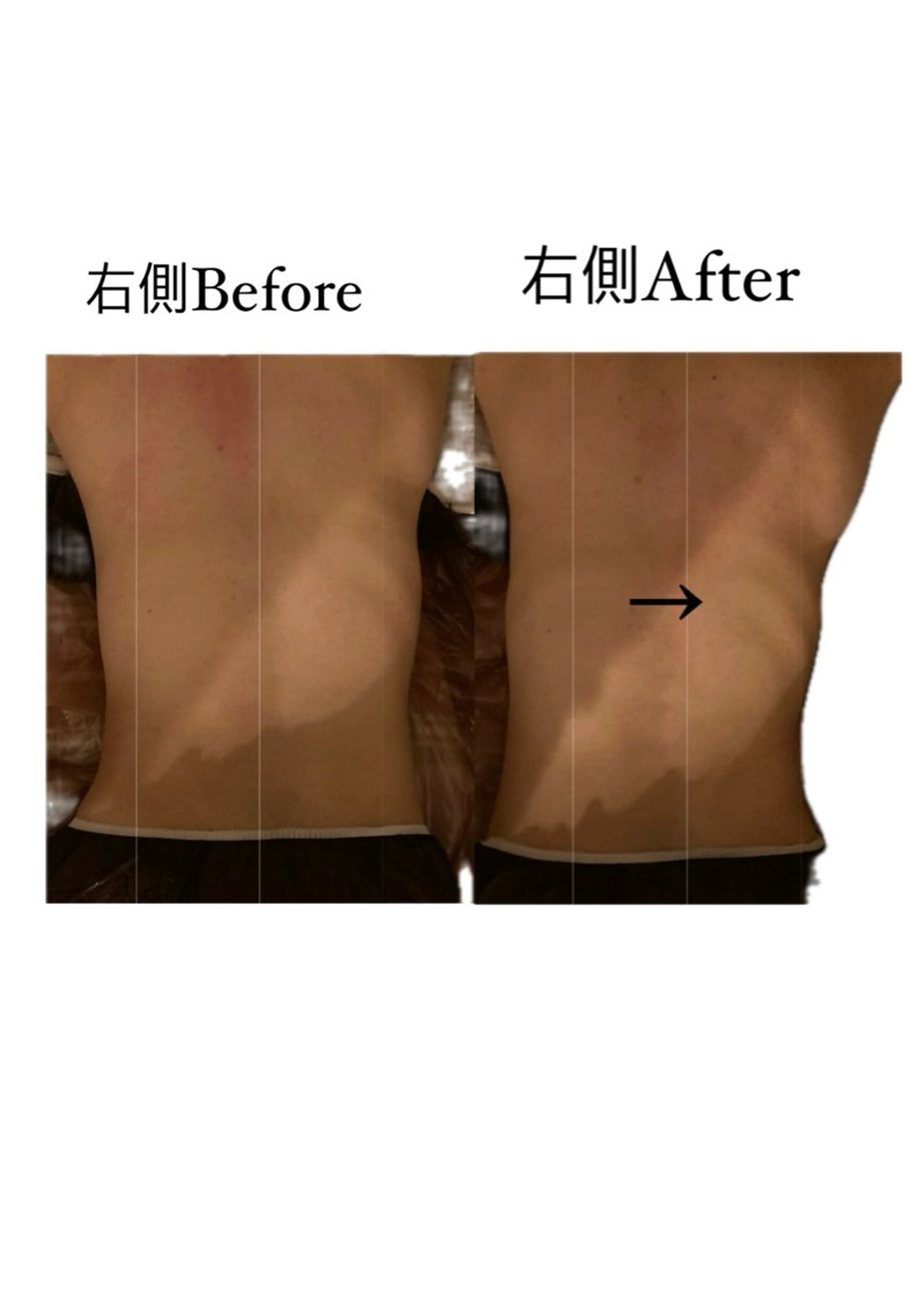 Bon glanzのエステ・リラクイメージ