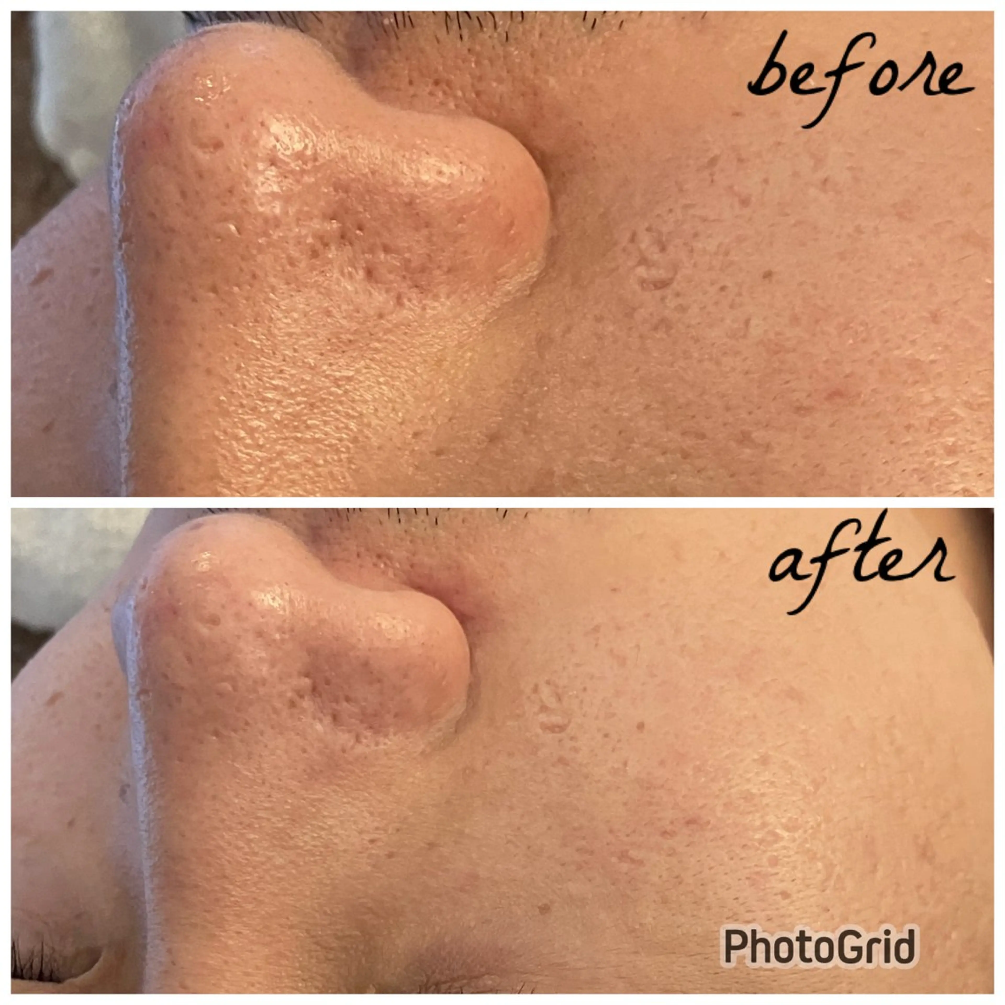 メンズ メナード岐阜茜部 杉浦のエステ・リラクイメージ