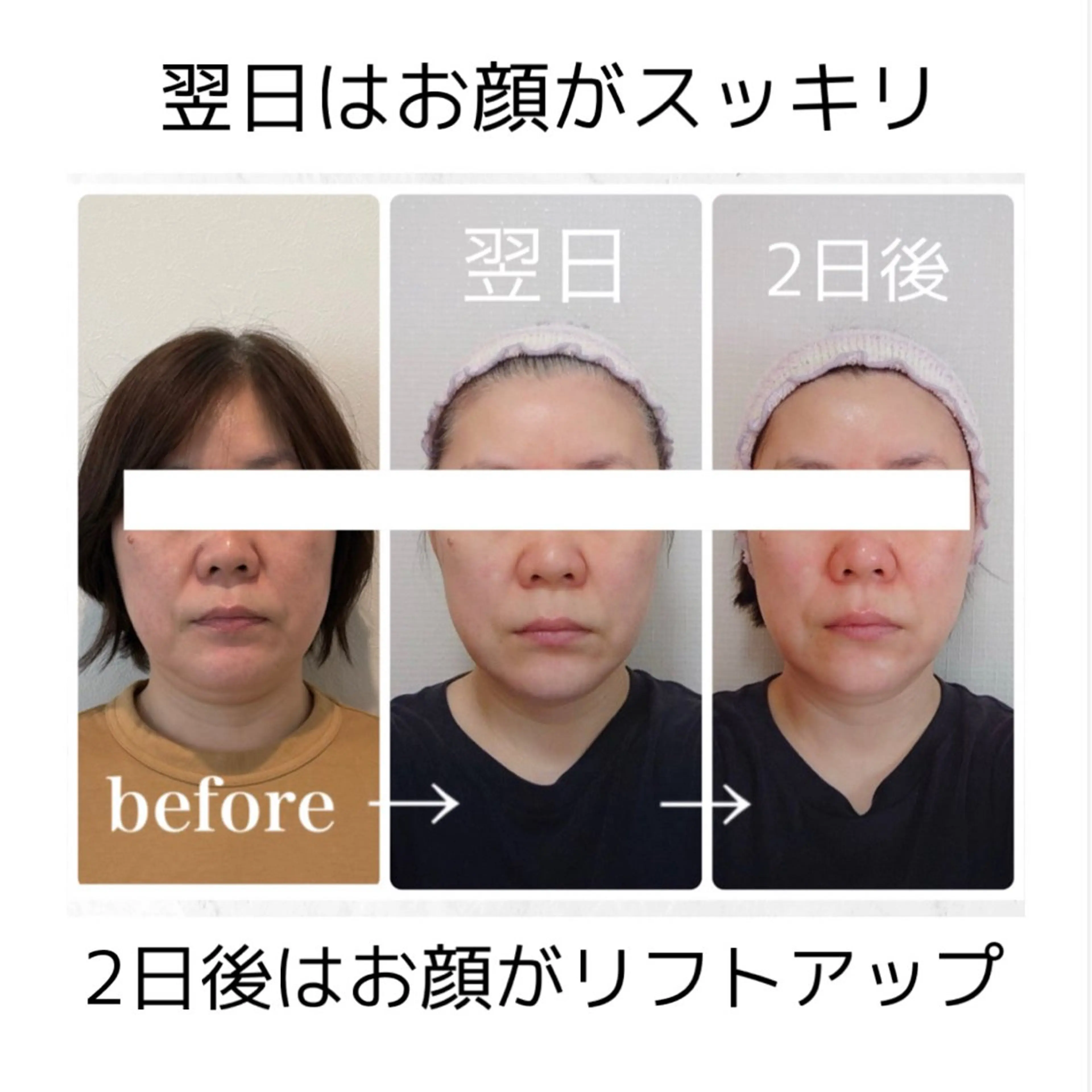 エステ リラク 小顔と ヘッドスパのお店のエステ・リラクイメージ