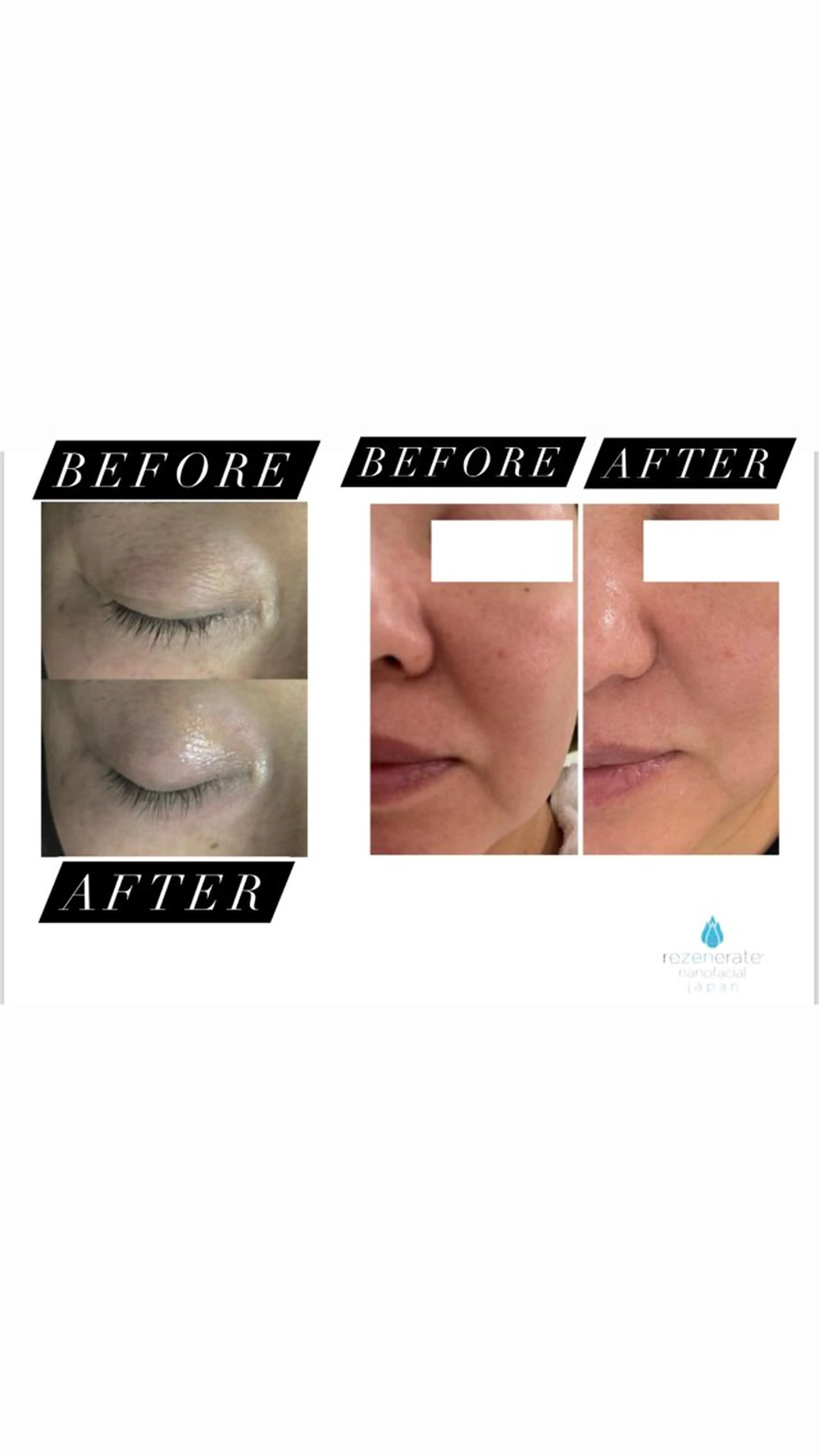 エステ 美容整体・塗る漢方・フェイシャルRechica所属・心斎橋痩身 美肌整体サロン💓のエステ・リラクイメージ