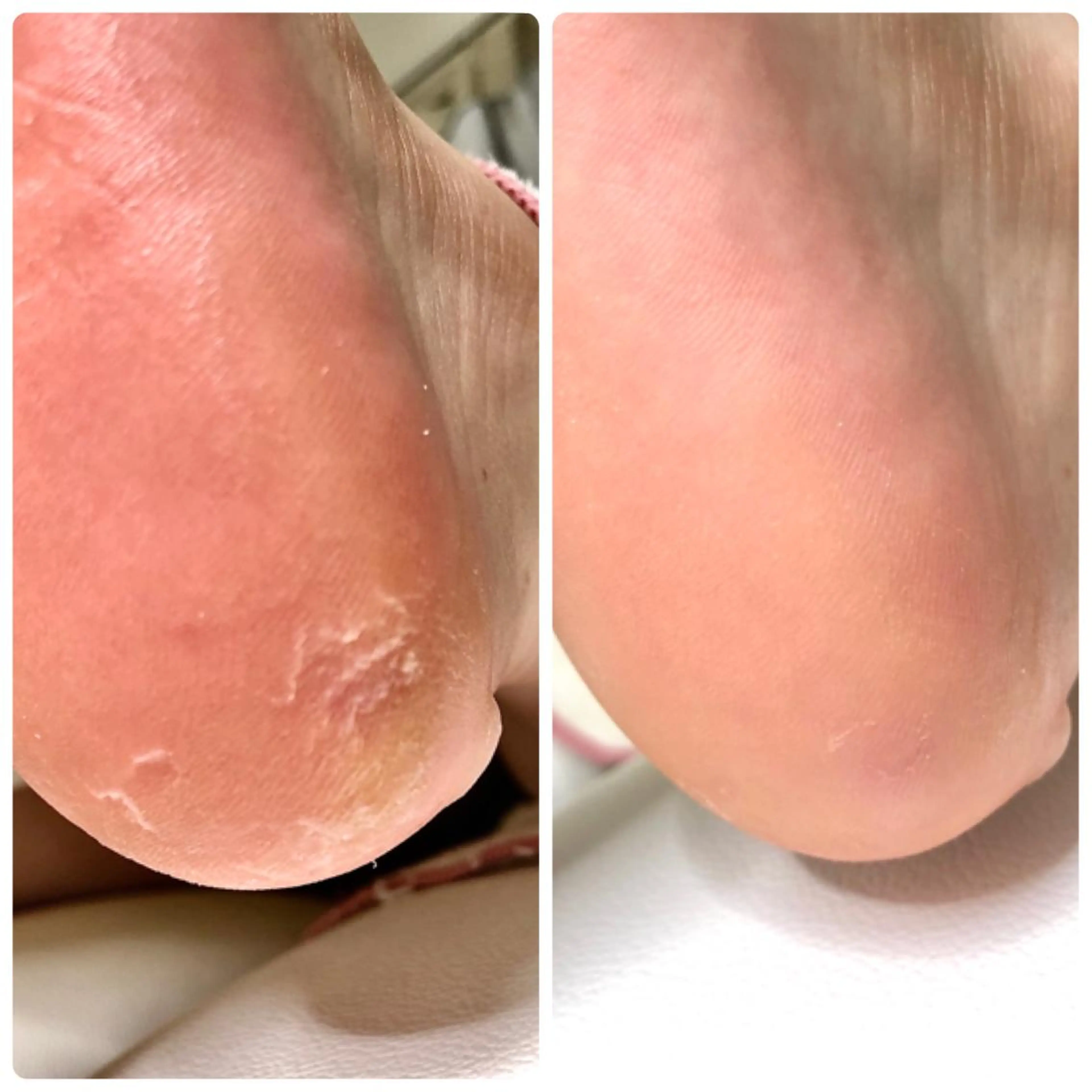 ネイル ⭐️遠藤 夏純⭐️のエステ・リラクイメージ