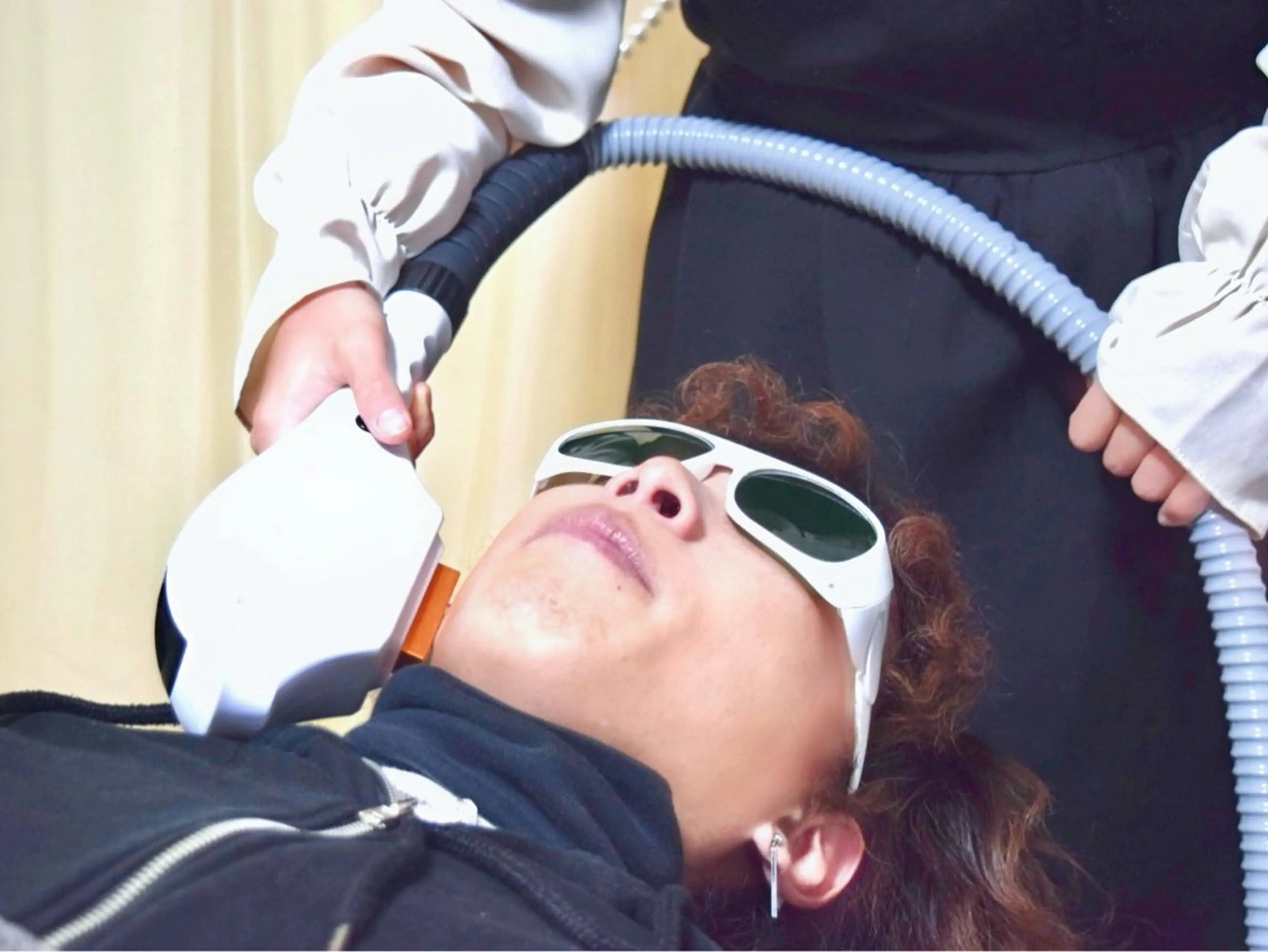 【ヒゲ脱毛】レベル調整・相談可◎しっかり抜き取る脱毛と痛みの少ない脱毛が選べます！の写真