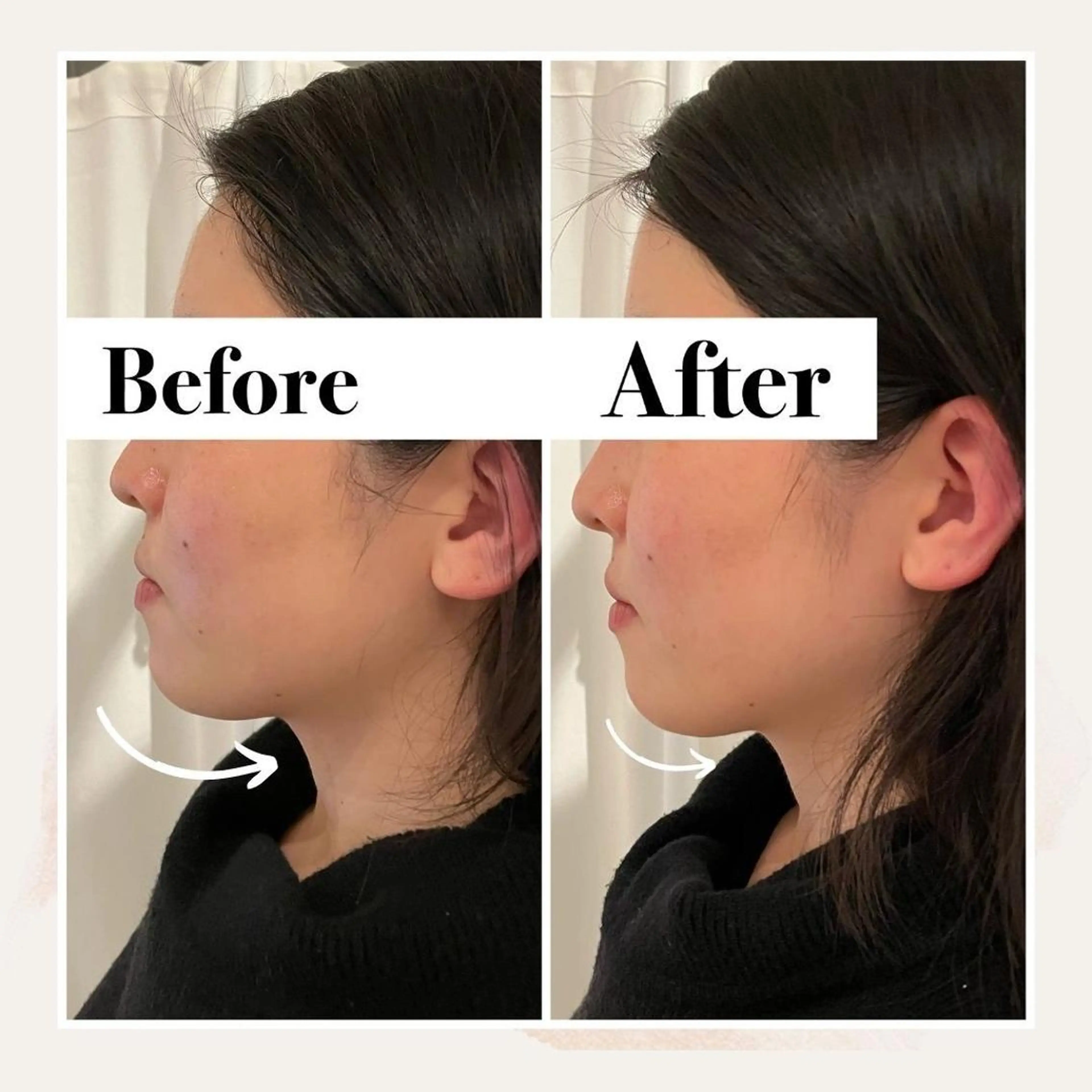 エステ リラク 12Dハイフ💗 最強小顔のエステ・リラクイメージ