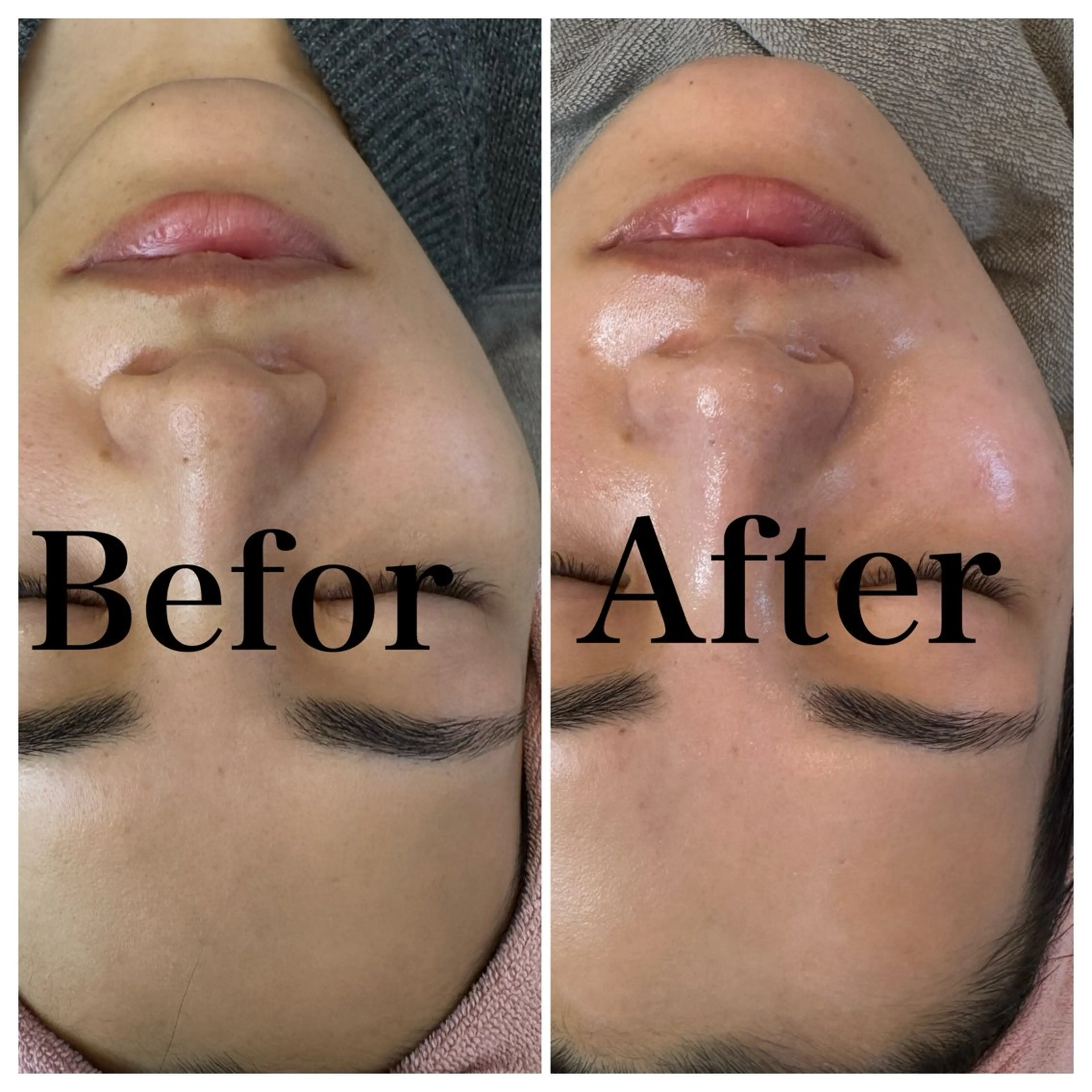 美肌管理サロン　ペルボヌール所属・韓国美肌管理サロン ペルボヌールのエステ・リラクイメージ