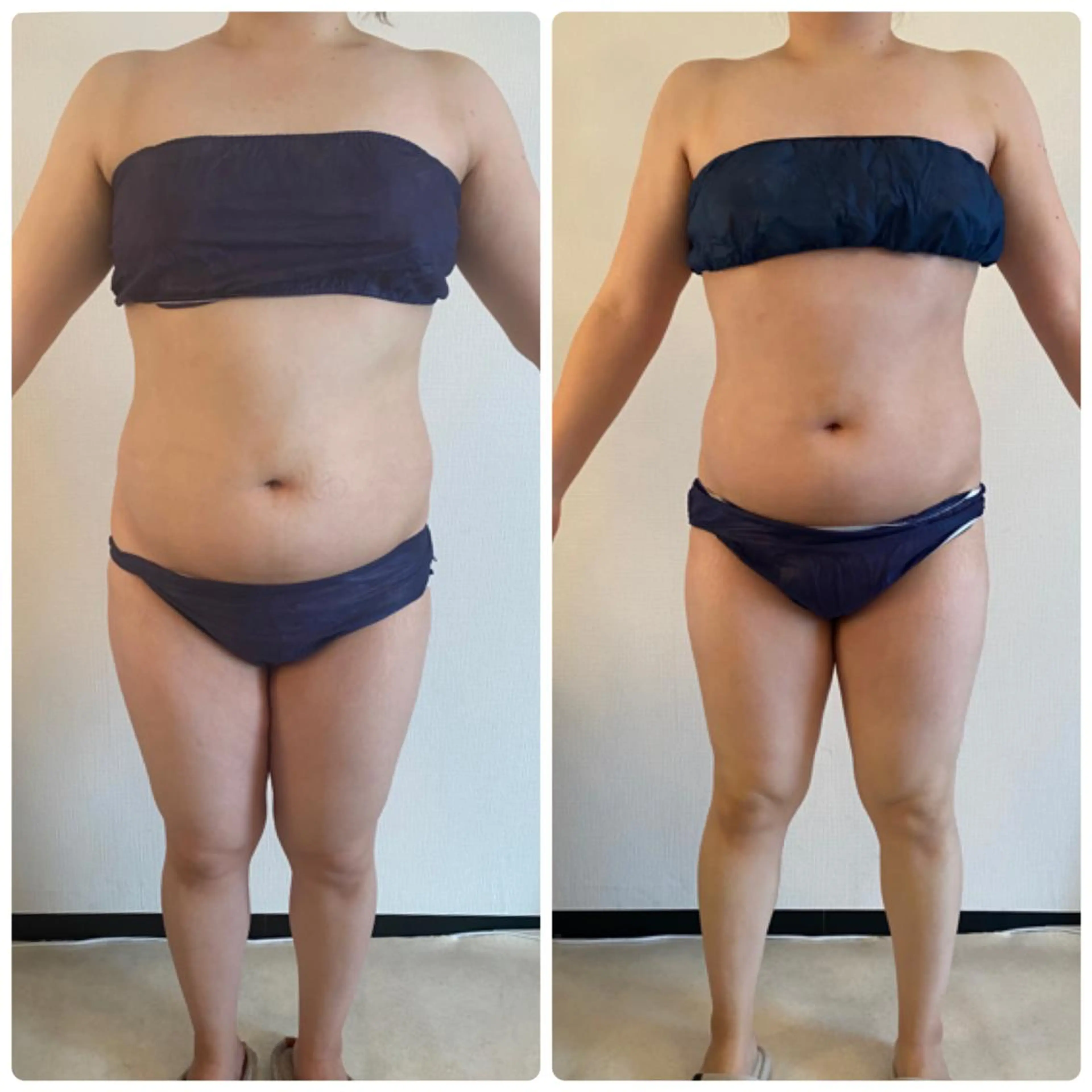 FLEUR大阪・美容 整体・痩身・小顔のエステ・リラクイメージ