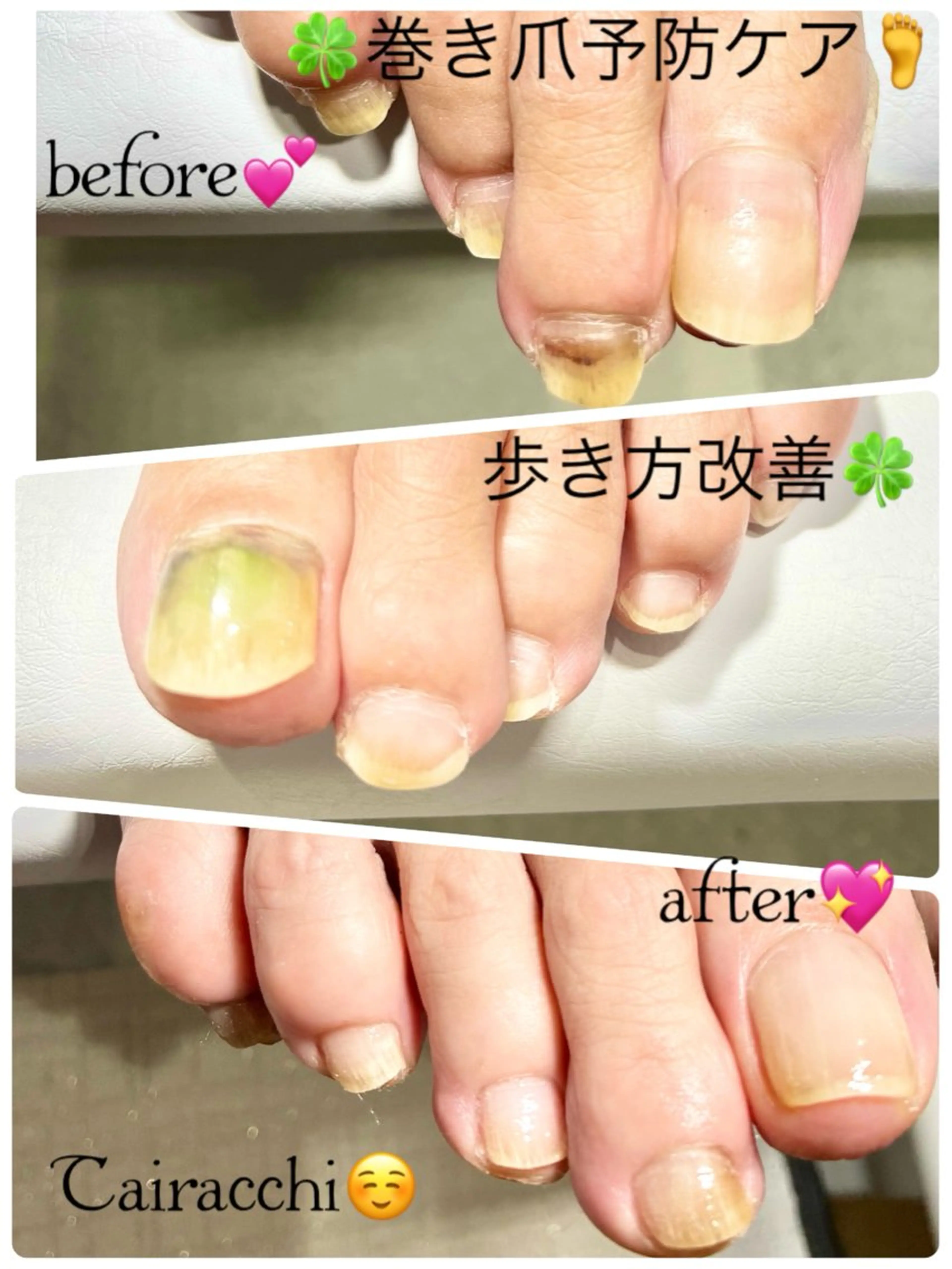 ネイル フットネイル フットネイル Tairacchi ﾀｲﾗｯﾁのエステ・リラクイメージ