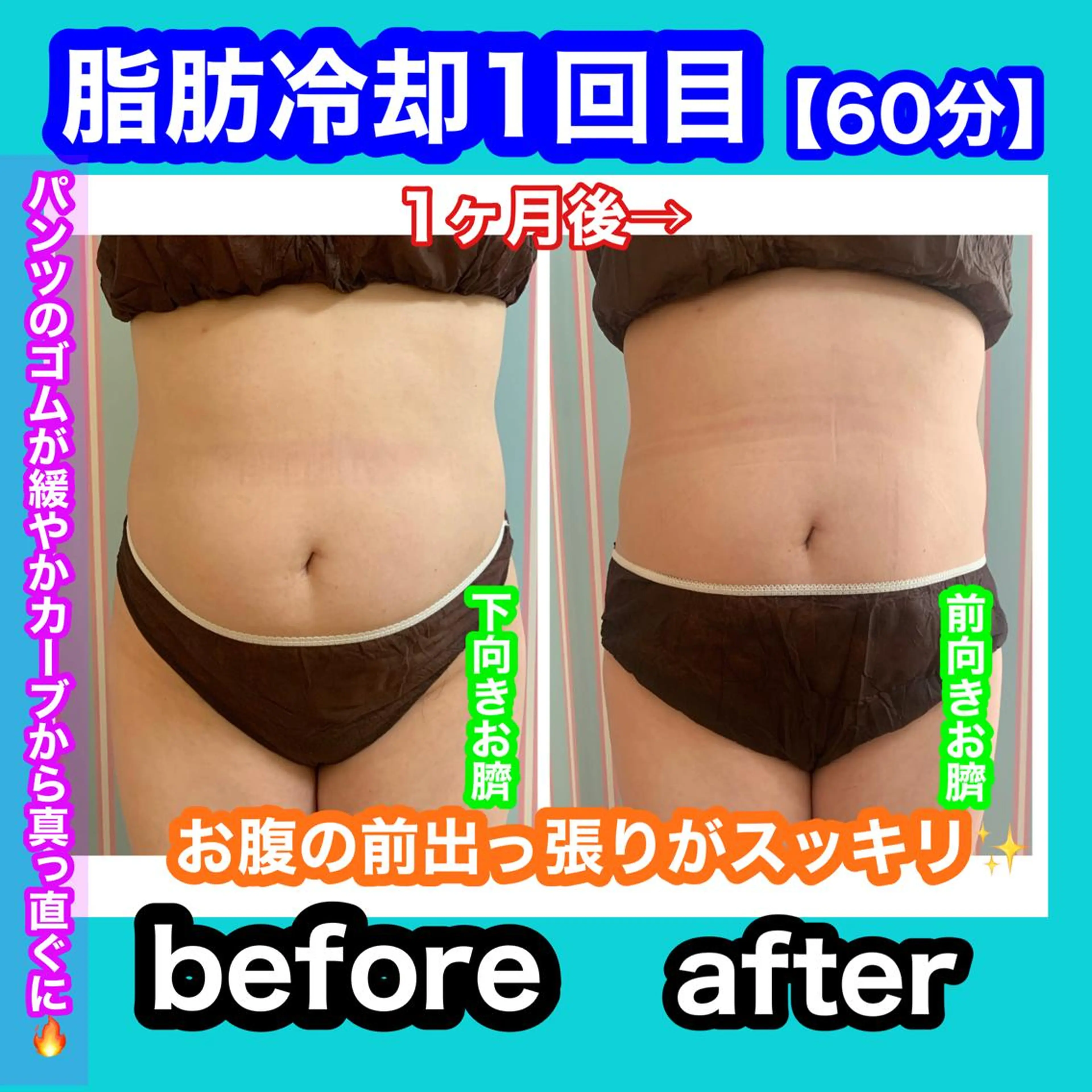 エステ リラク 痩身/脱毛/ネイル HARUKAのエステ・リラクイメージ