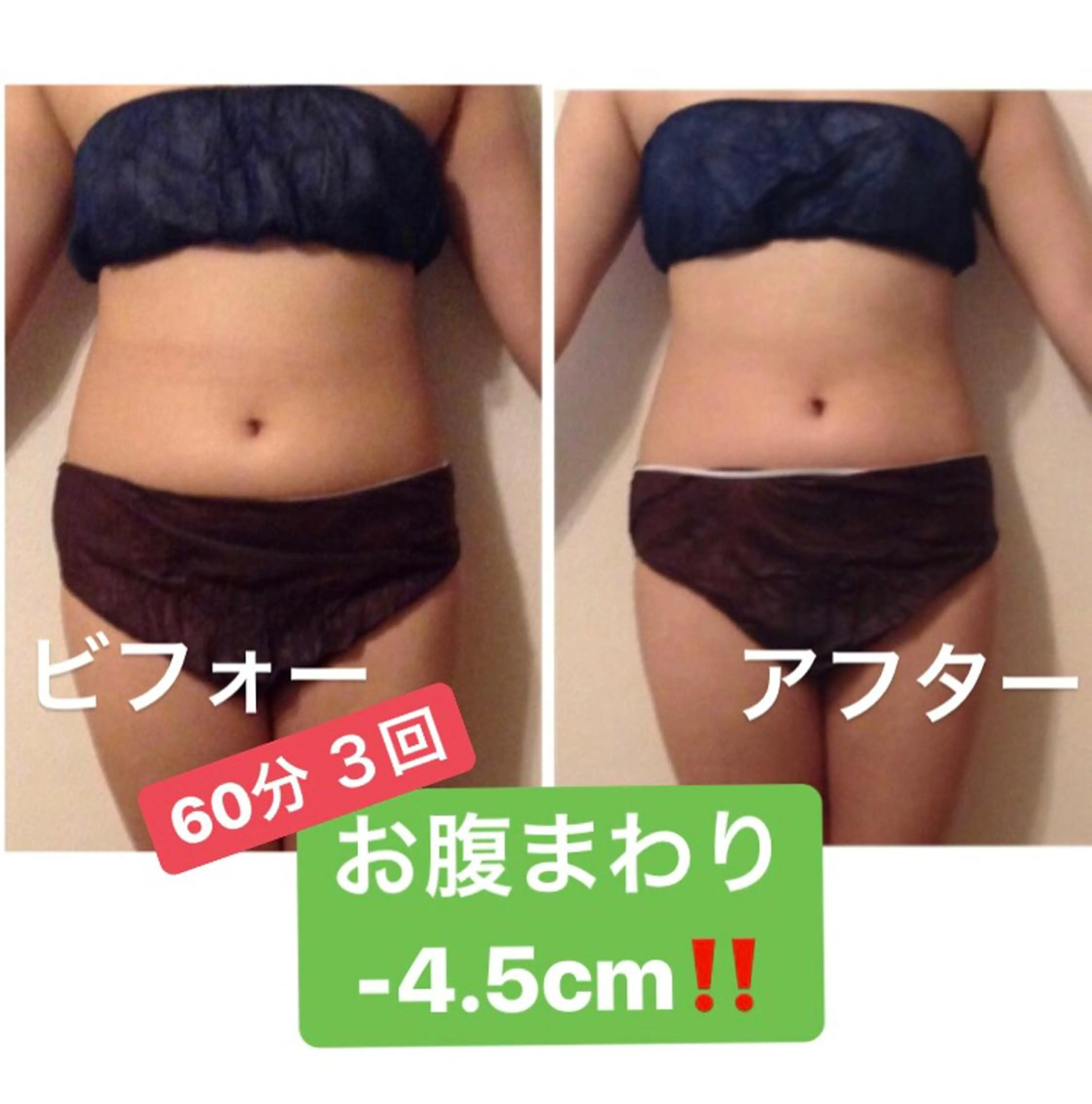 小尻・太もも痩せる エステルナボーテのエステ・リラクイメージ