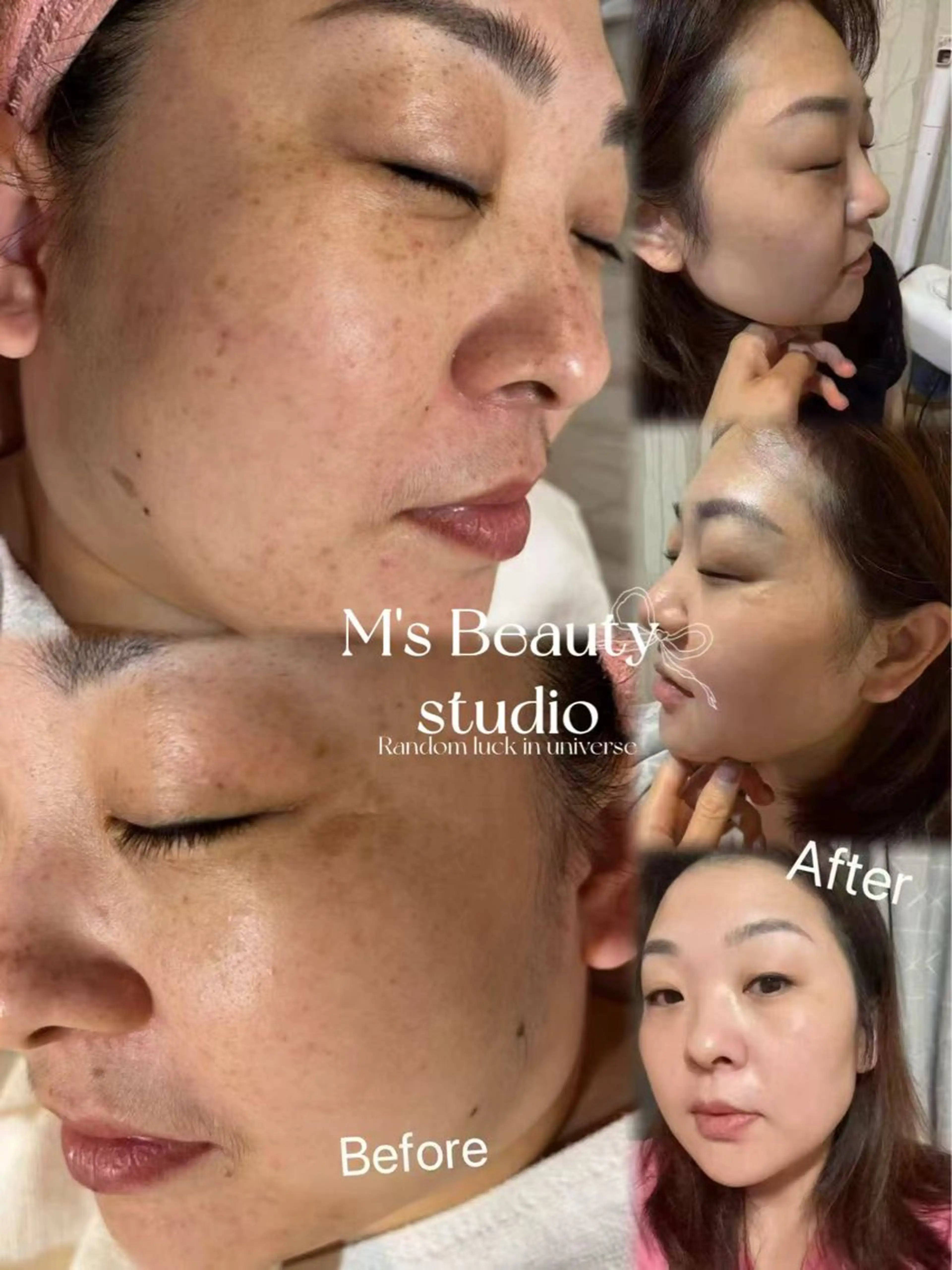 エステ エムズ ビューティスタジオのエステ・リラクイメージ