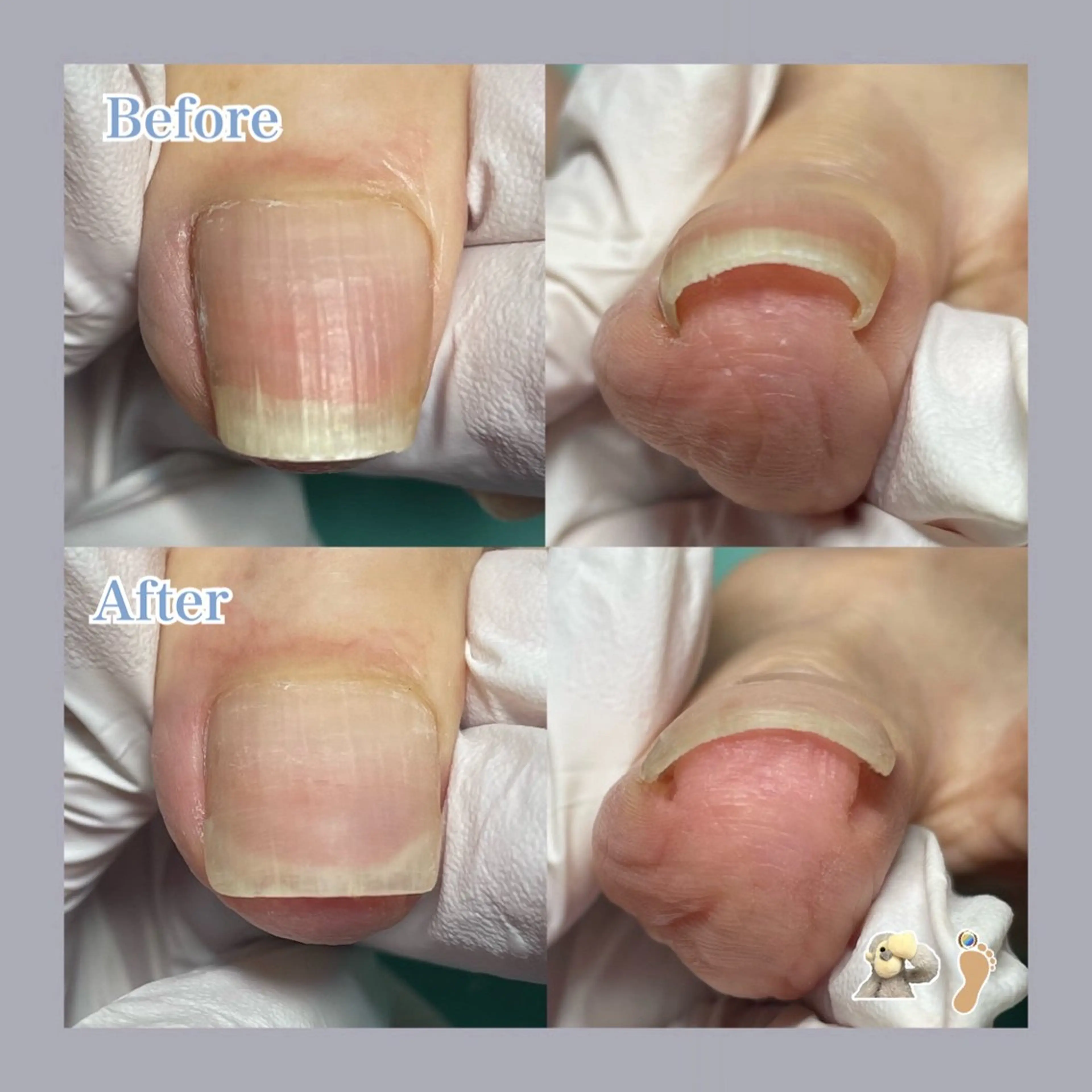 ネイル 巻き爪補正店 大阪天王寺店のネイルデザイン