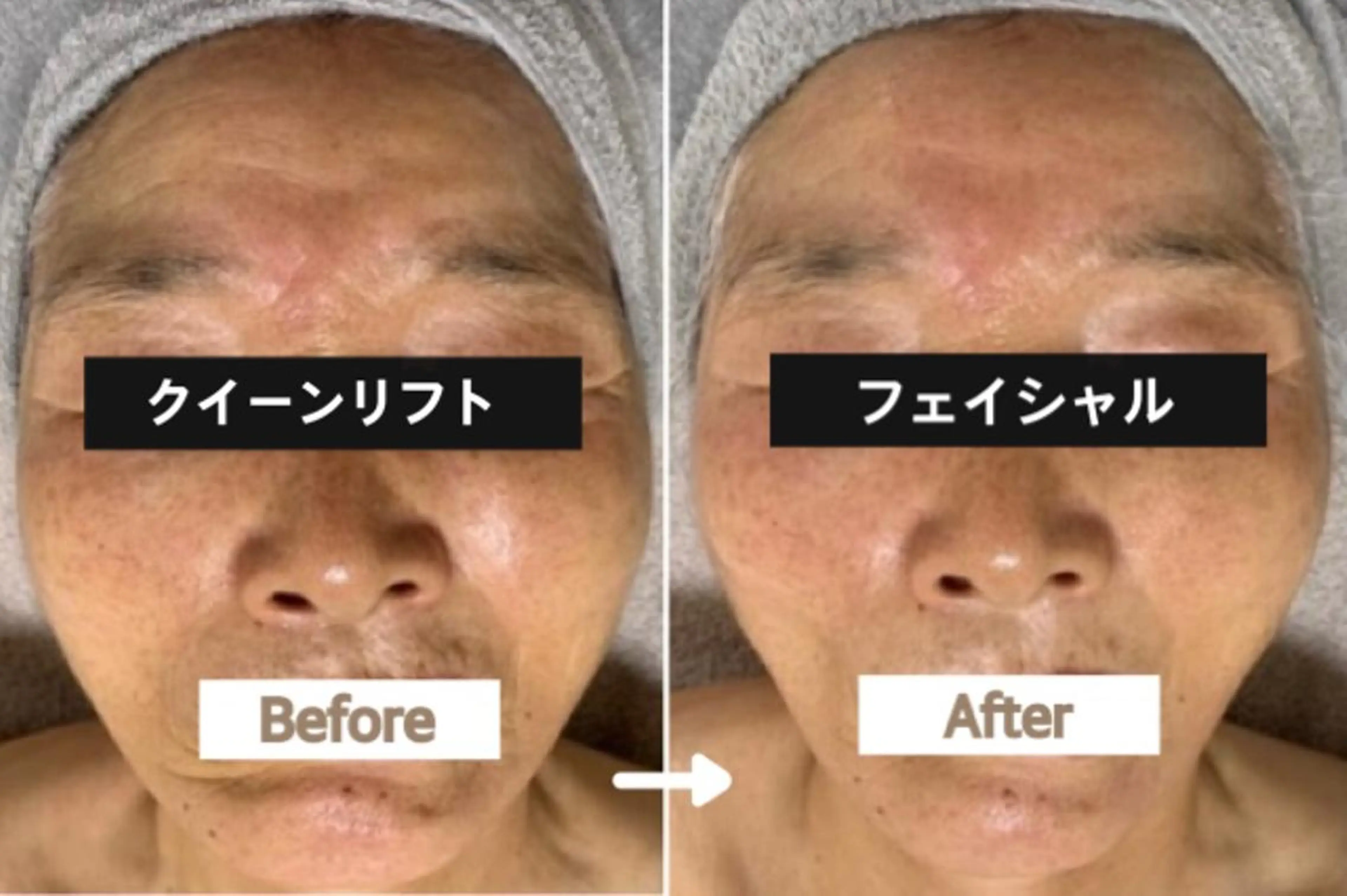 その他 ヴィーナス ビューティーのエステ・リラクイメージ