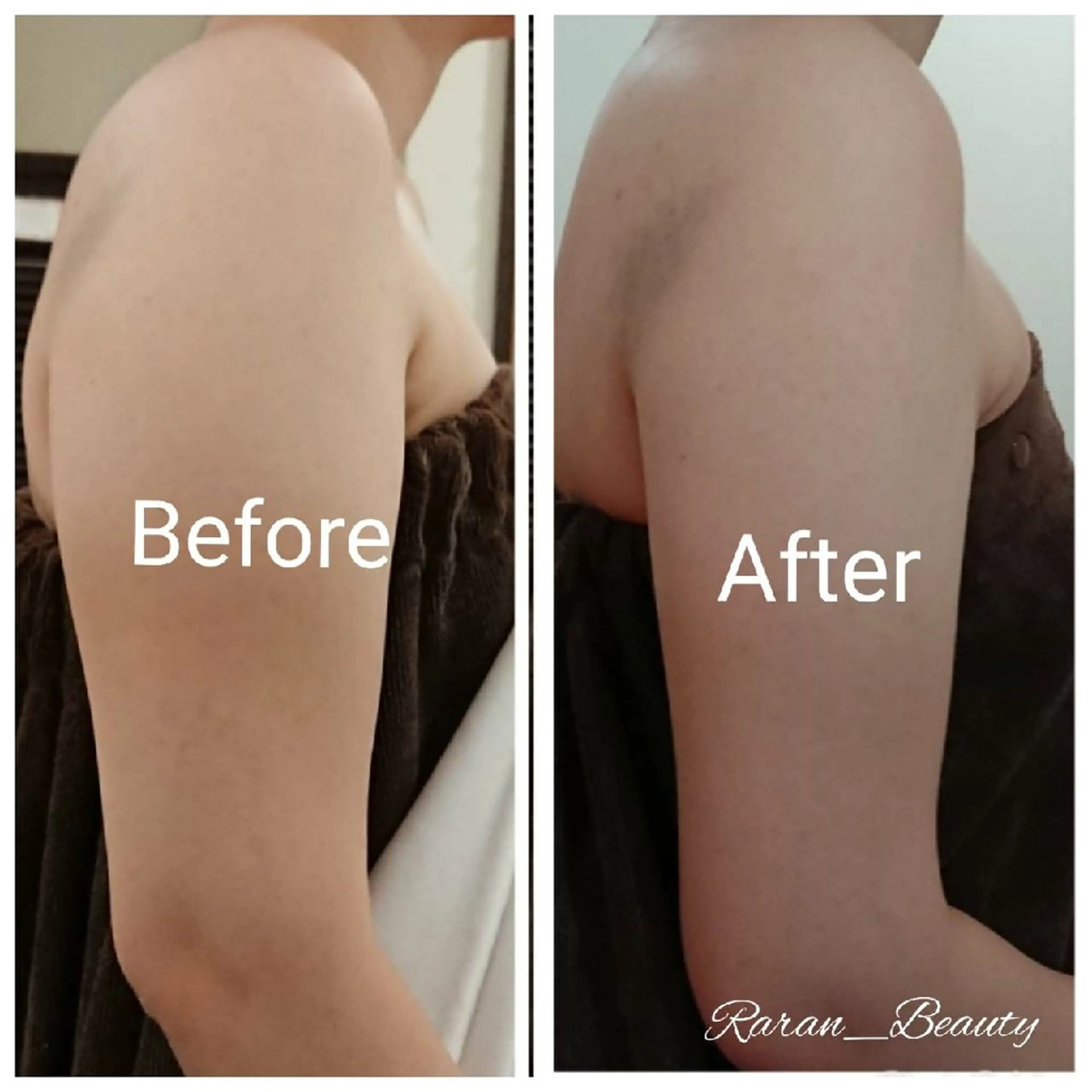 若返り 美肌   エステサロンららんのエステ・リラクイメージ