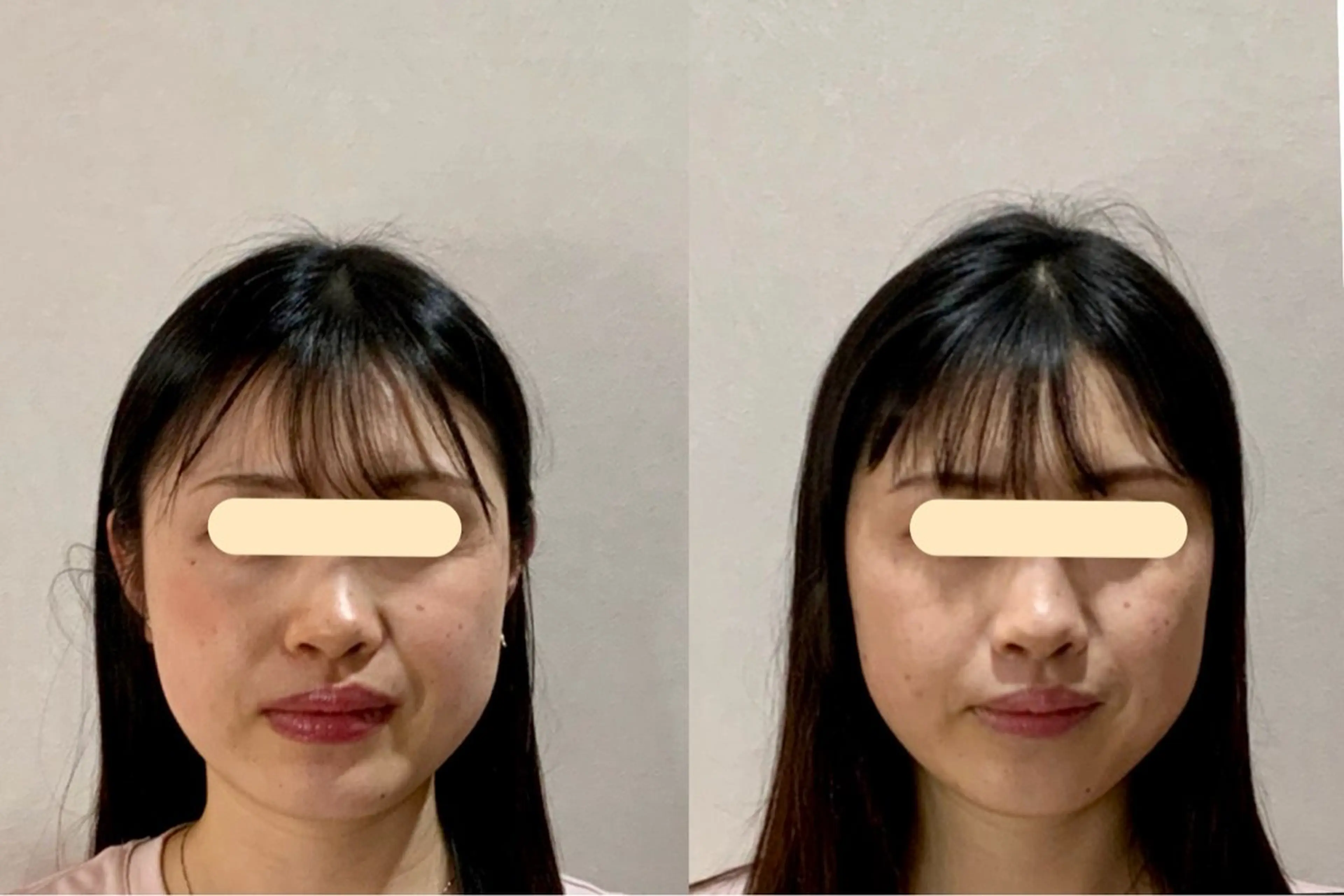 エステ 最速小顔・肌質管理 ❣️エスポワールのエステ・リラクイメージ