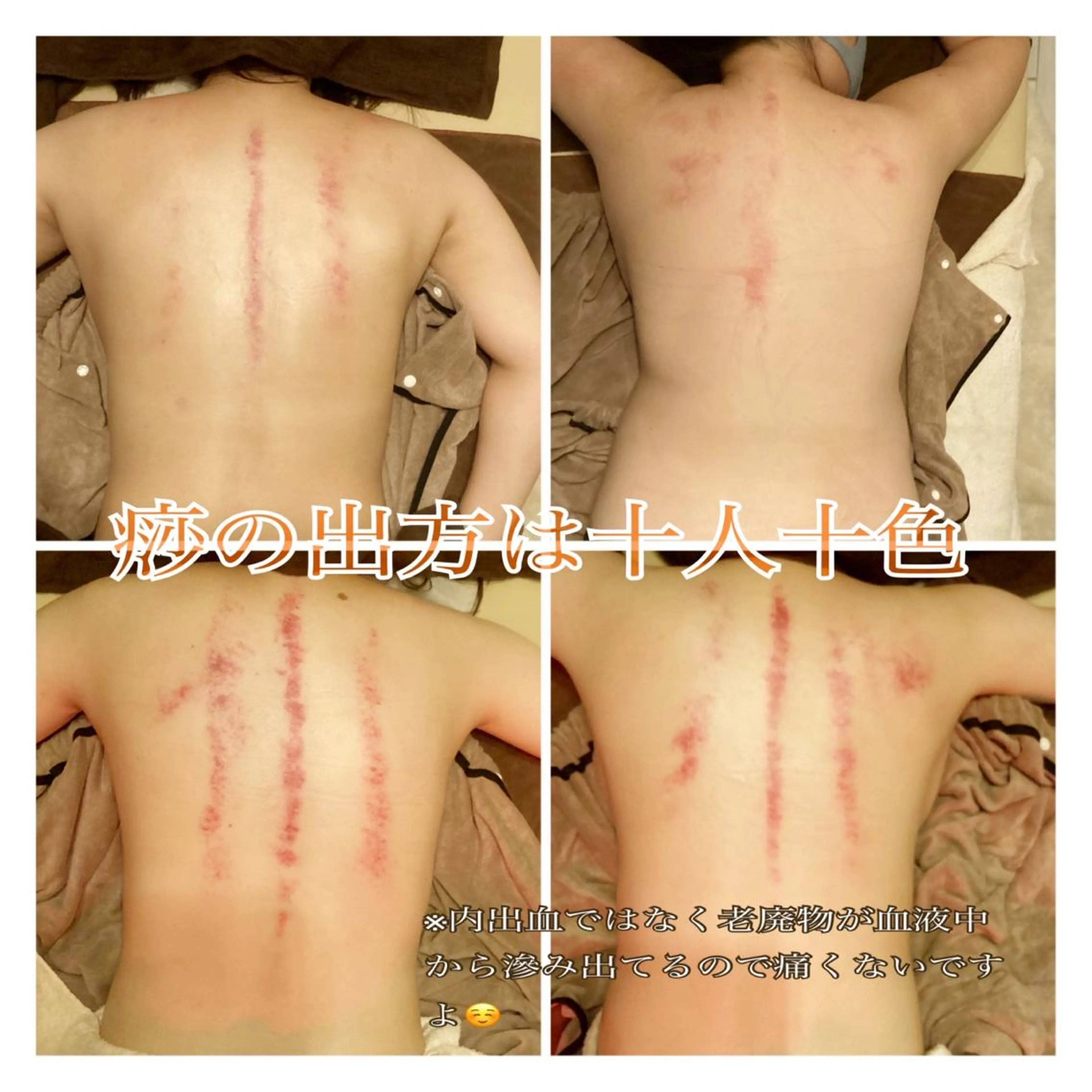 美腸専門 漢方よもぎ蒸しのエステ・リラクイメージ