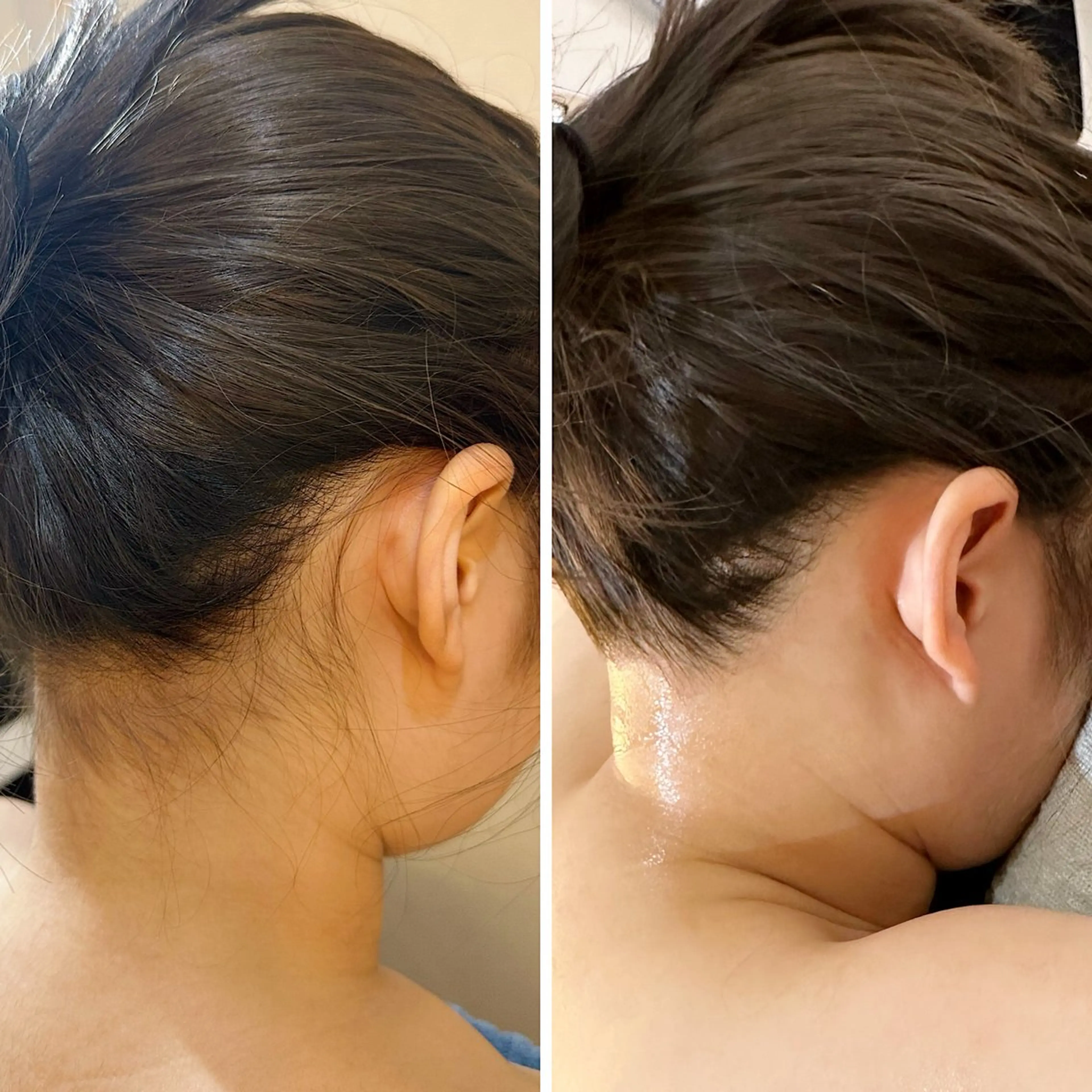 脱毛 うなじ脱毛/美肌脱毛 LABELのエステ・リラクイメージ