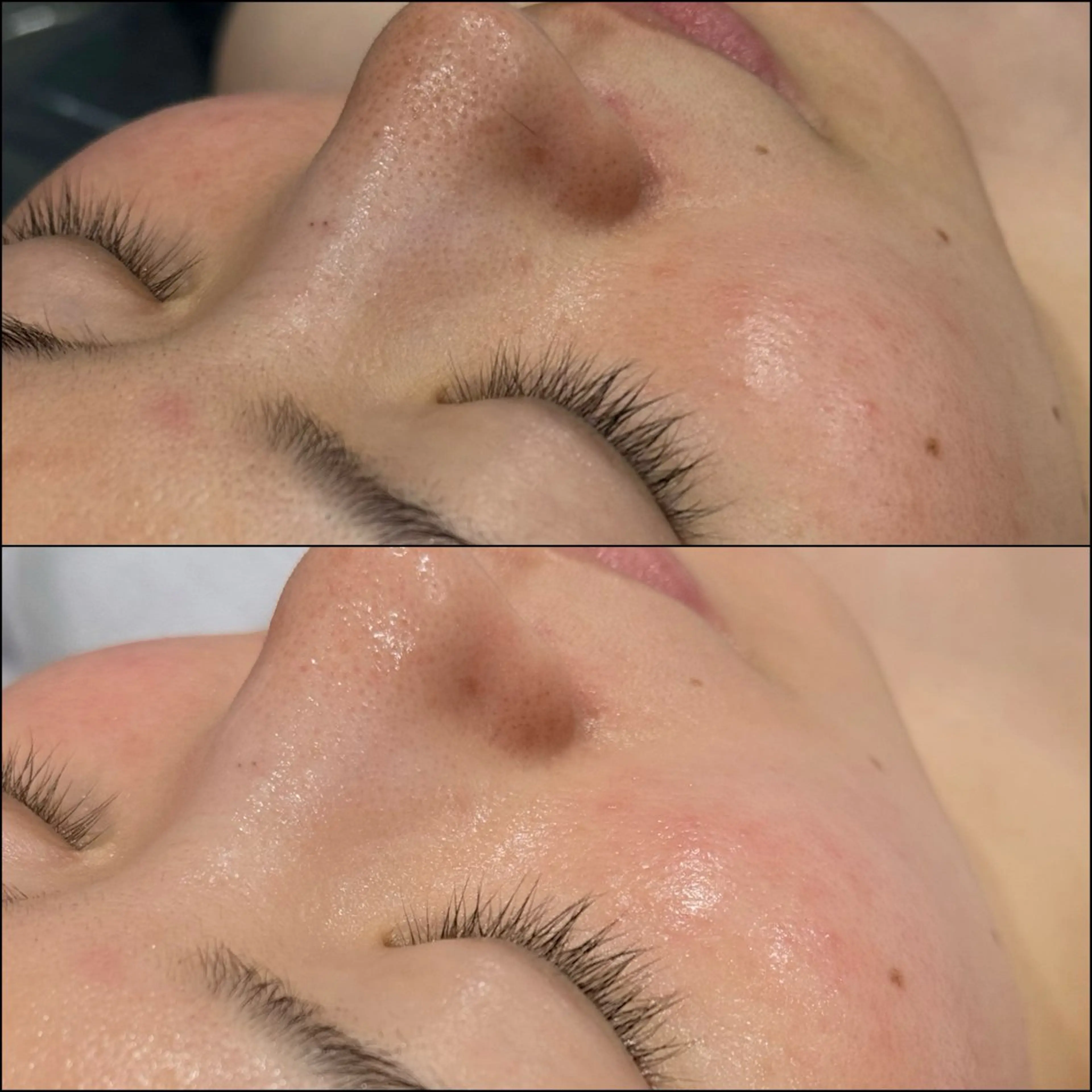 エステ LiZA エステティックサロンのエステ・リラクイメージ