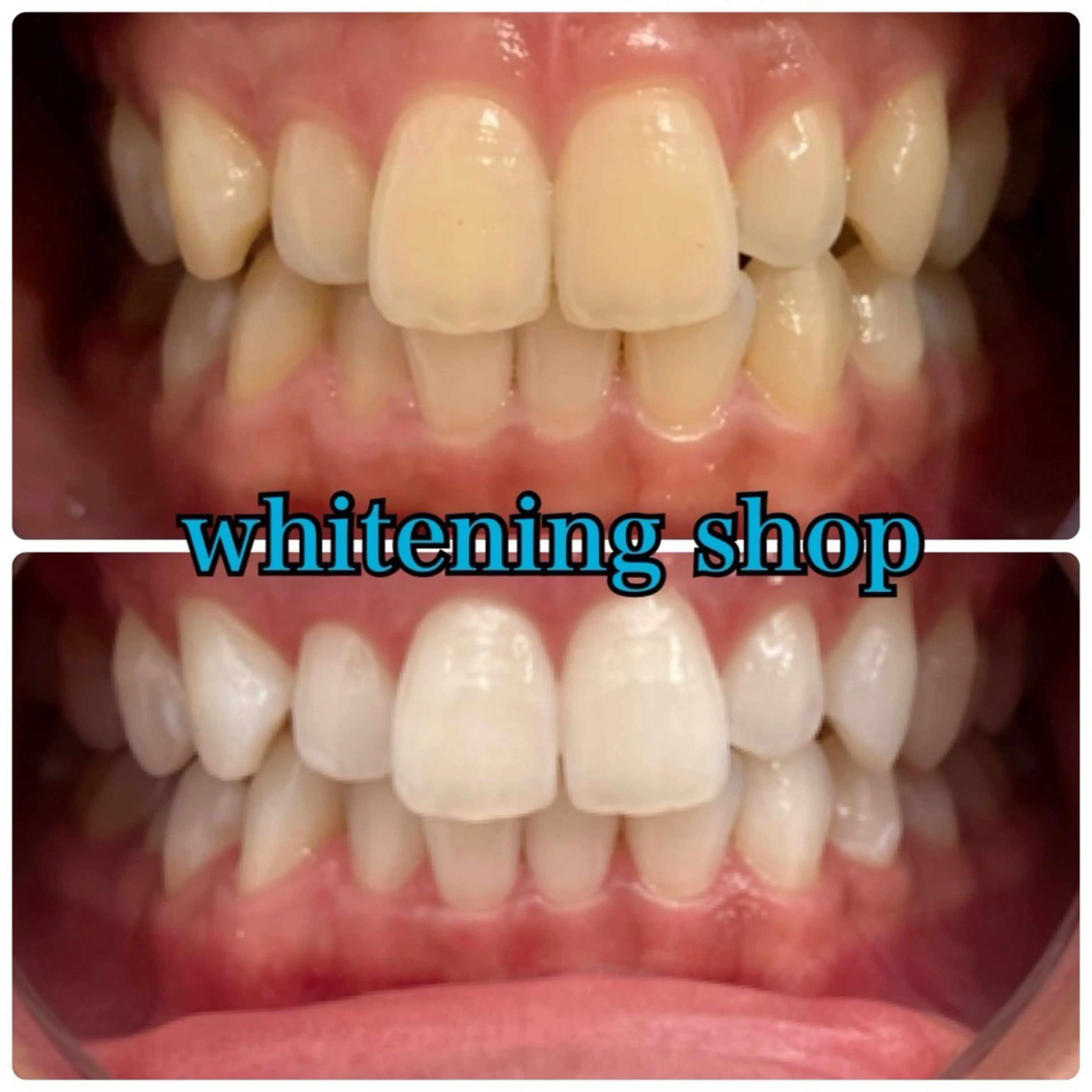 メンズ エステ リラク ホワイトニング ショップ川越店のエステ・リラクイメージ