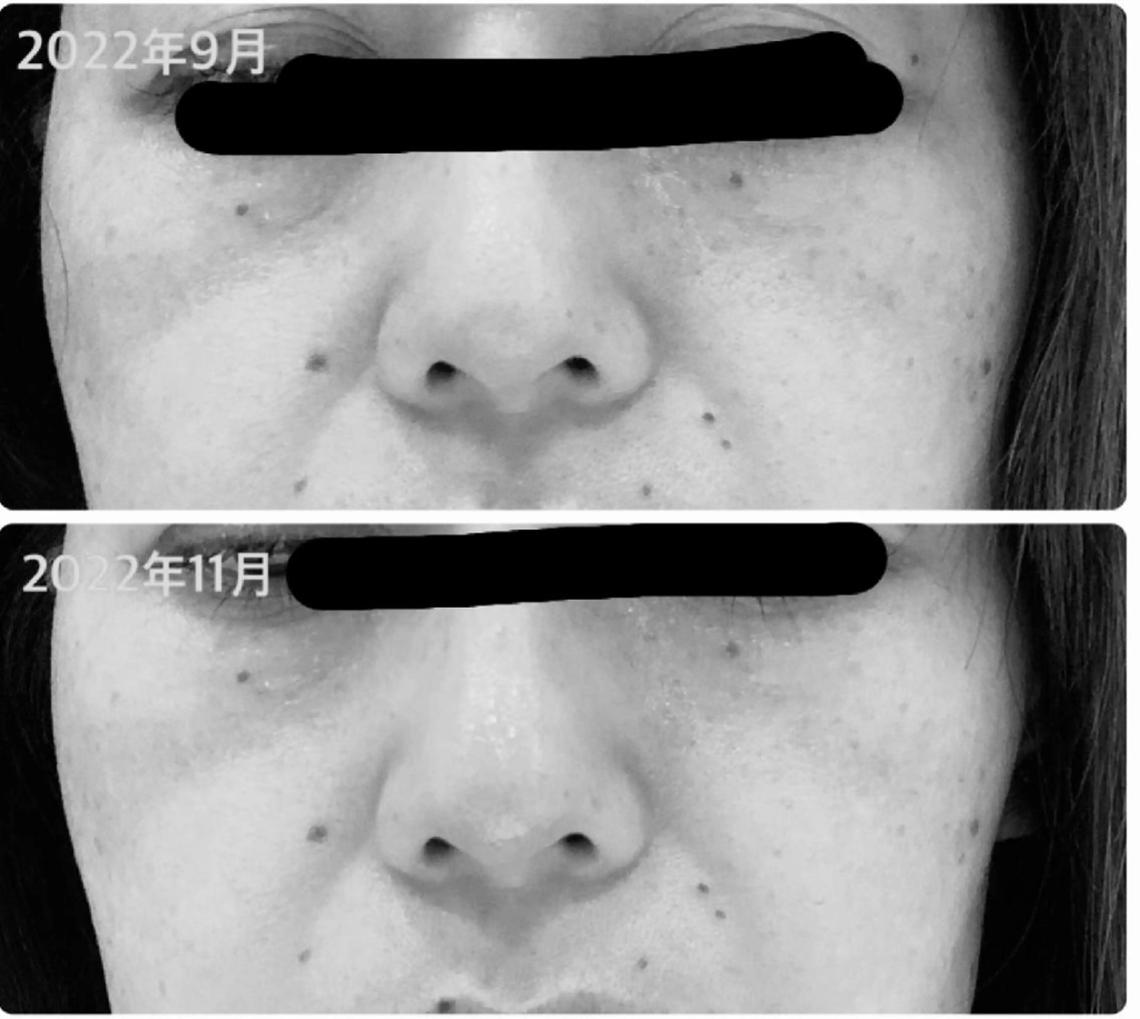 エステ Anabel所属・東 利恵のエステ・リラクイメージ