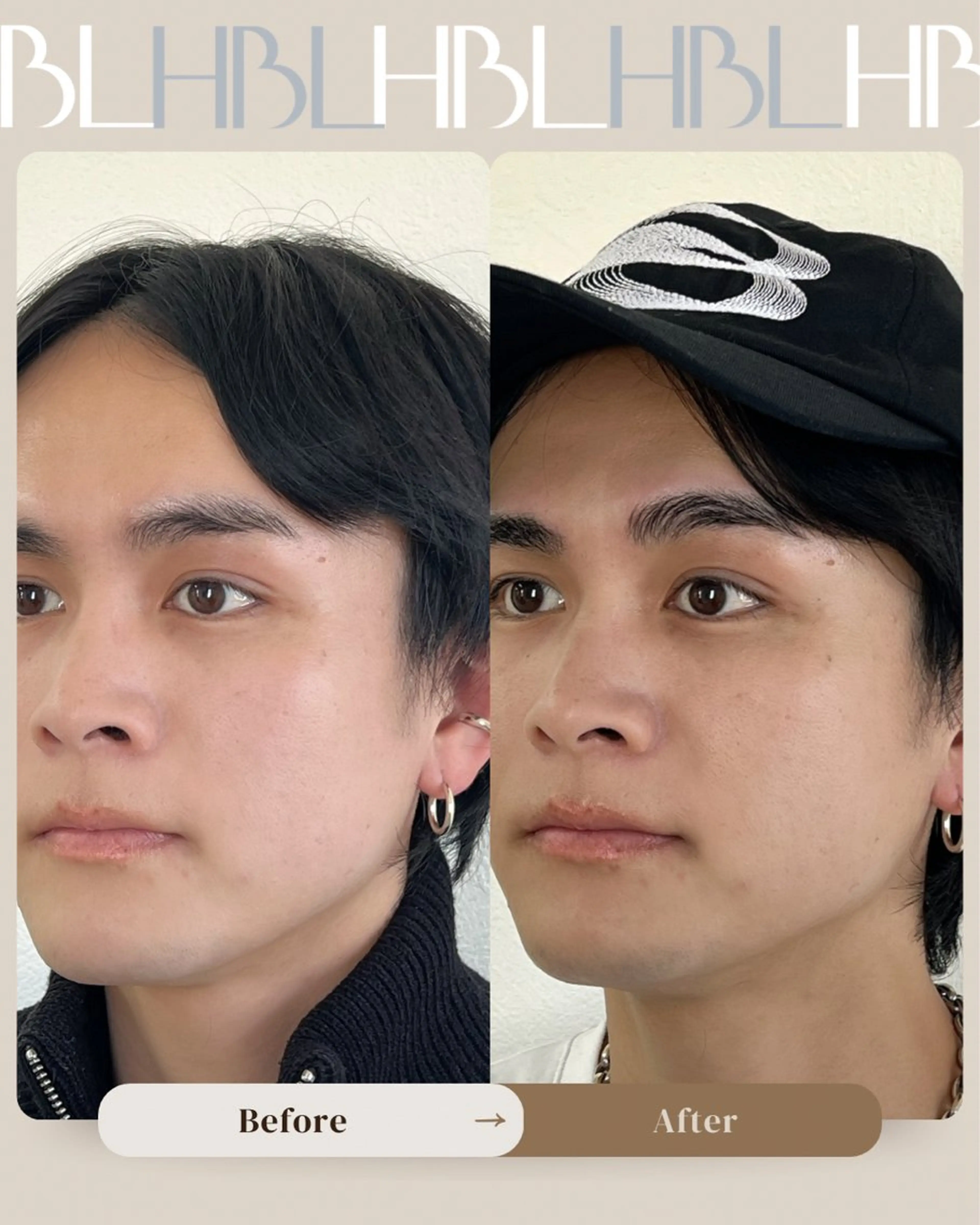 アイブロウ メンズアイブロウ ワックス脱毛 その他(アイブロウ) miyamai liaつくば店の眉毛・アイブロウイメージ