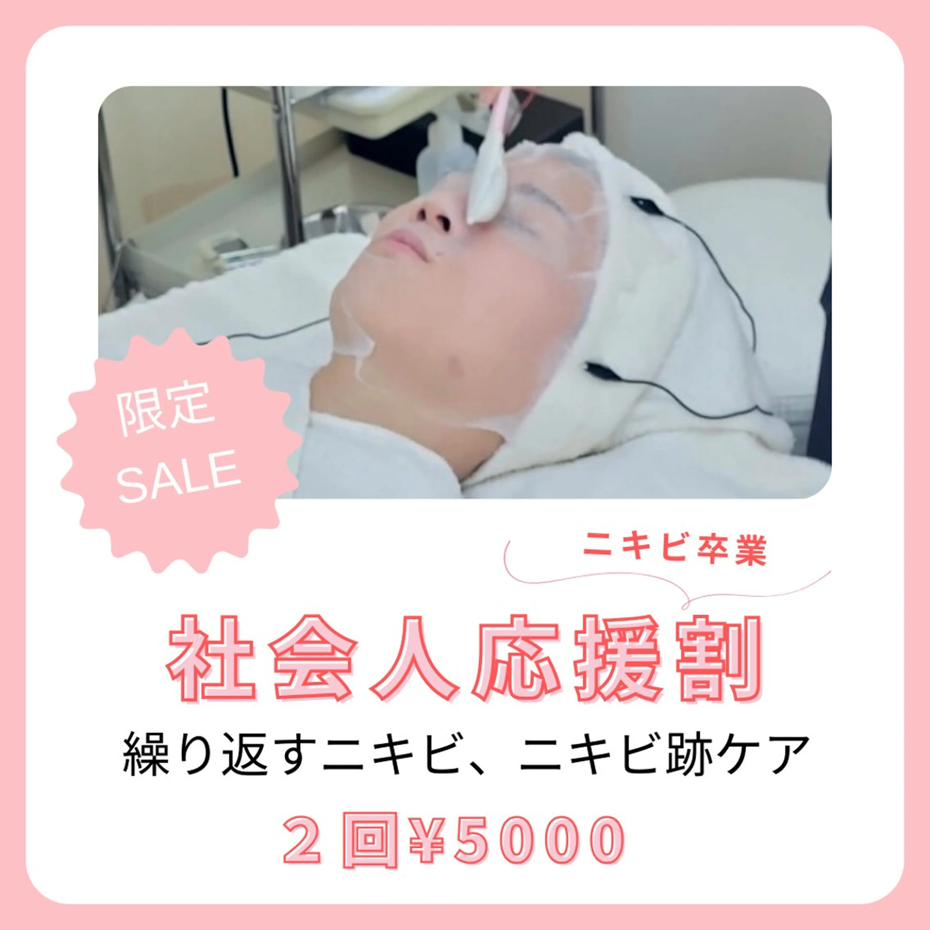 ニキビケア◇ニキビ跡 レゾン京橋店 八崎のエステ・リラクイメージ