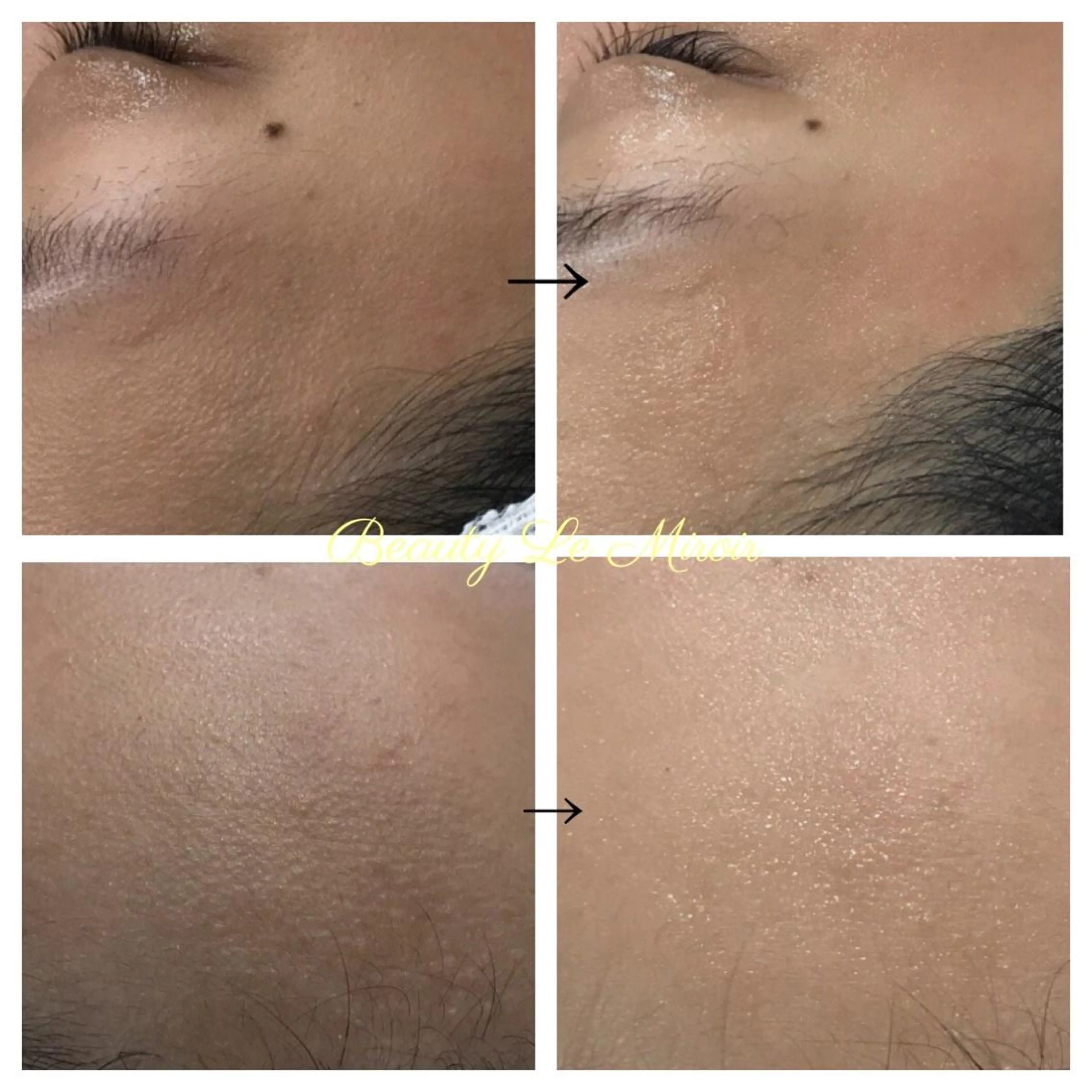 ビューティー ミロワールのエステ・リラクイメージ