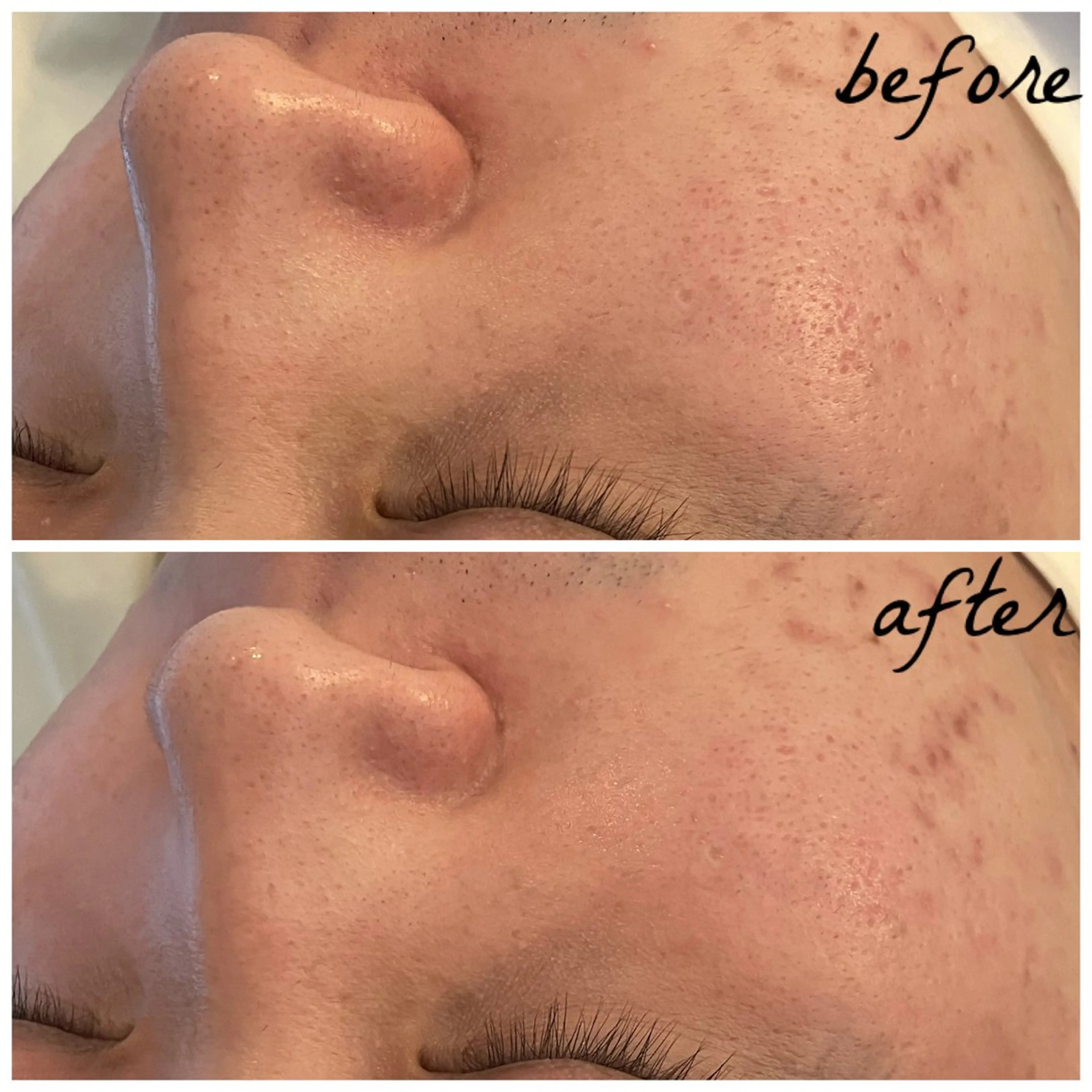 メンズ メナード岐阜茜部 杉浦のエステ・リラクイメージ