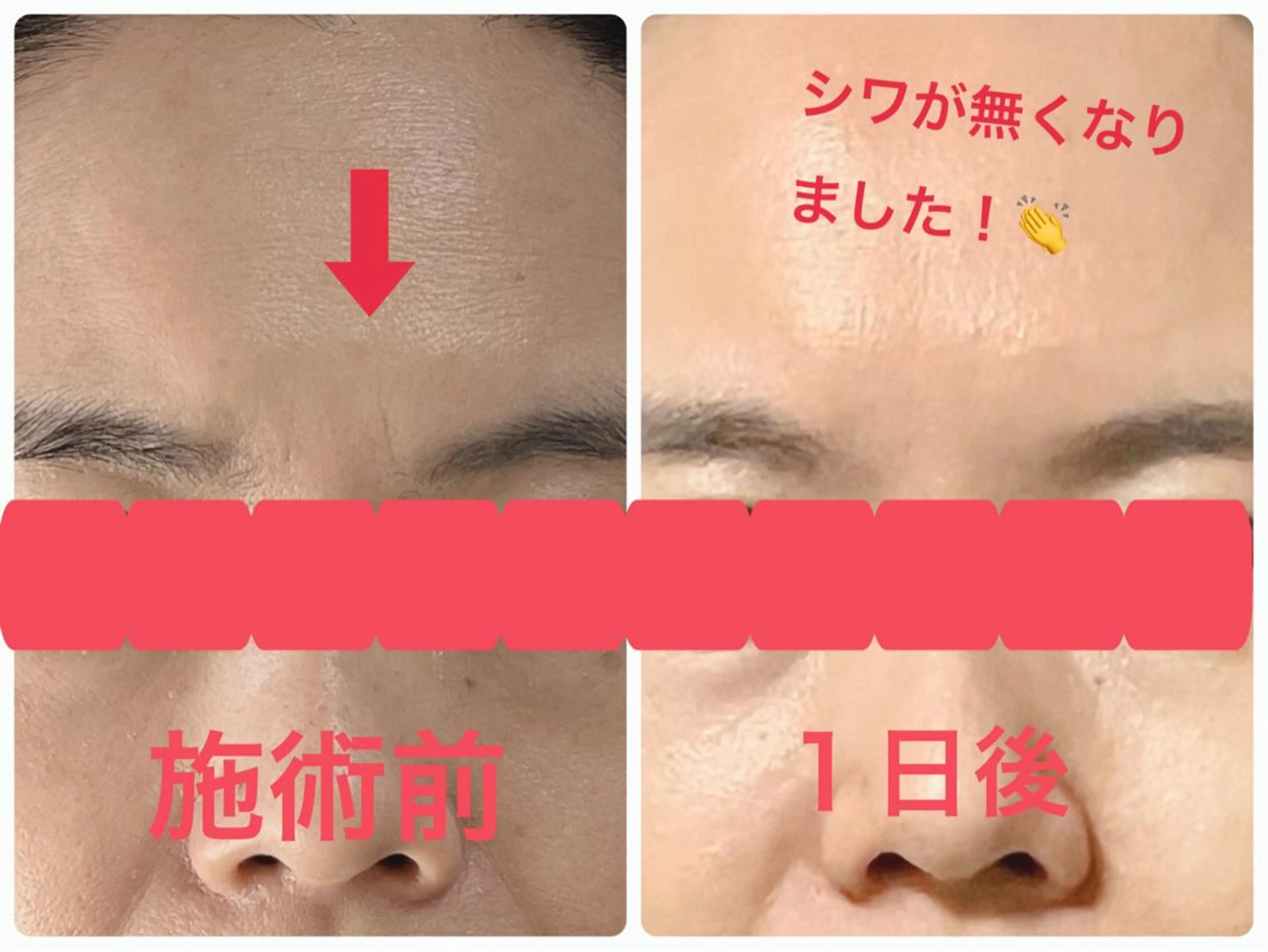 Serapia 【セラピア】のマツエク・マツパデザイン