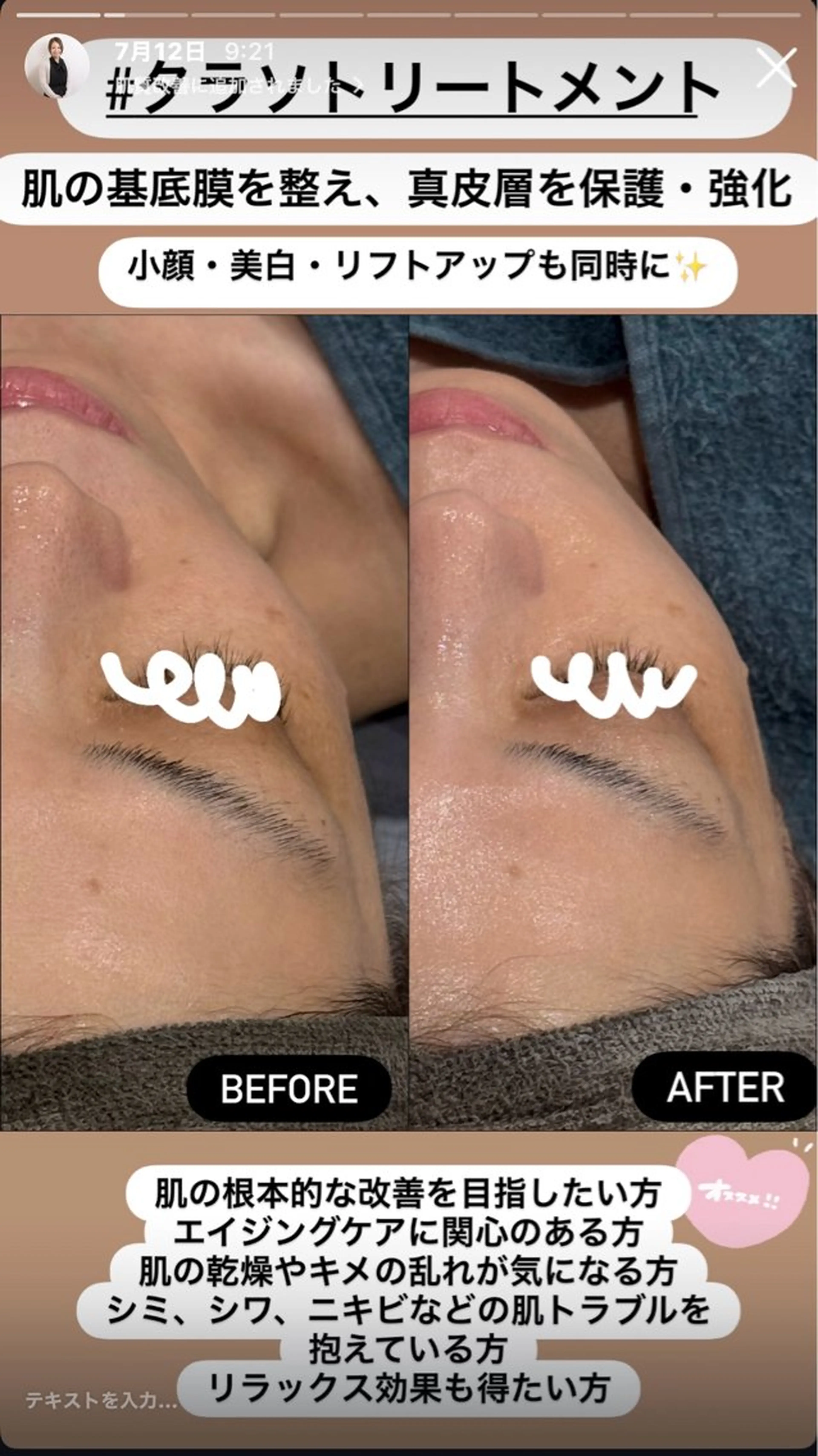 エステ LiZA エステティックサロンのエステ・リラクイメージ