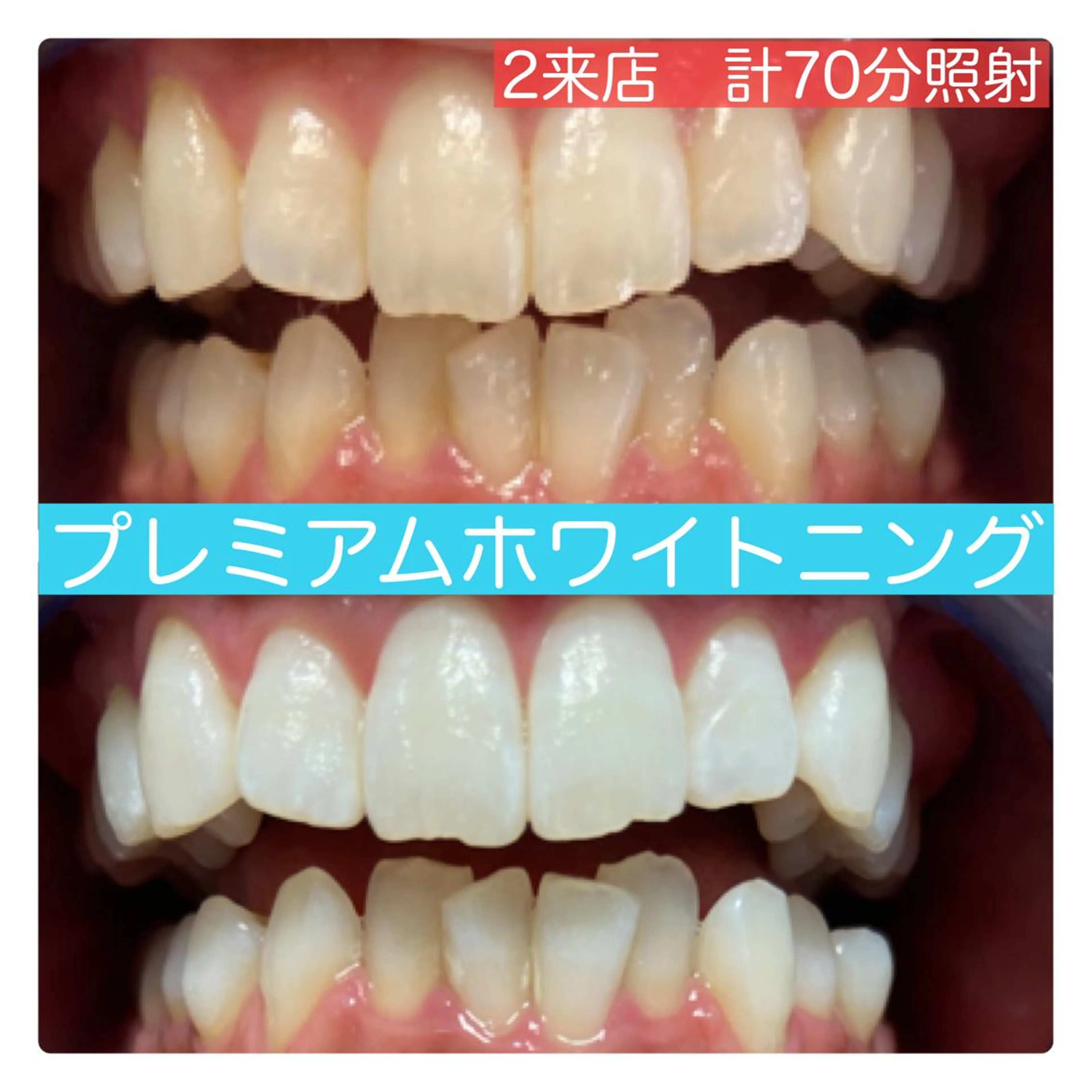 PLATINUM Beauty 横浜店所属・ホワイトニングルーム 横浜店のその他イメージ