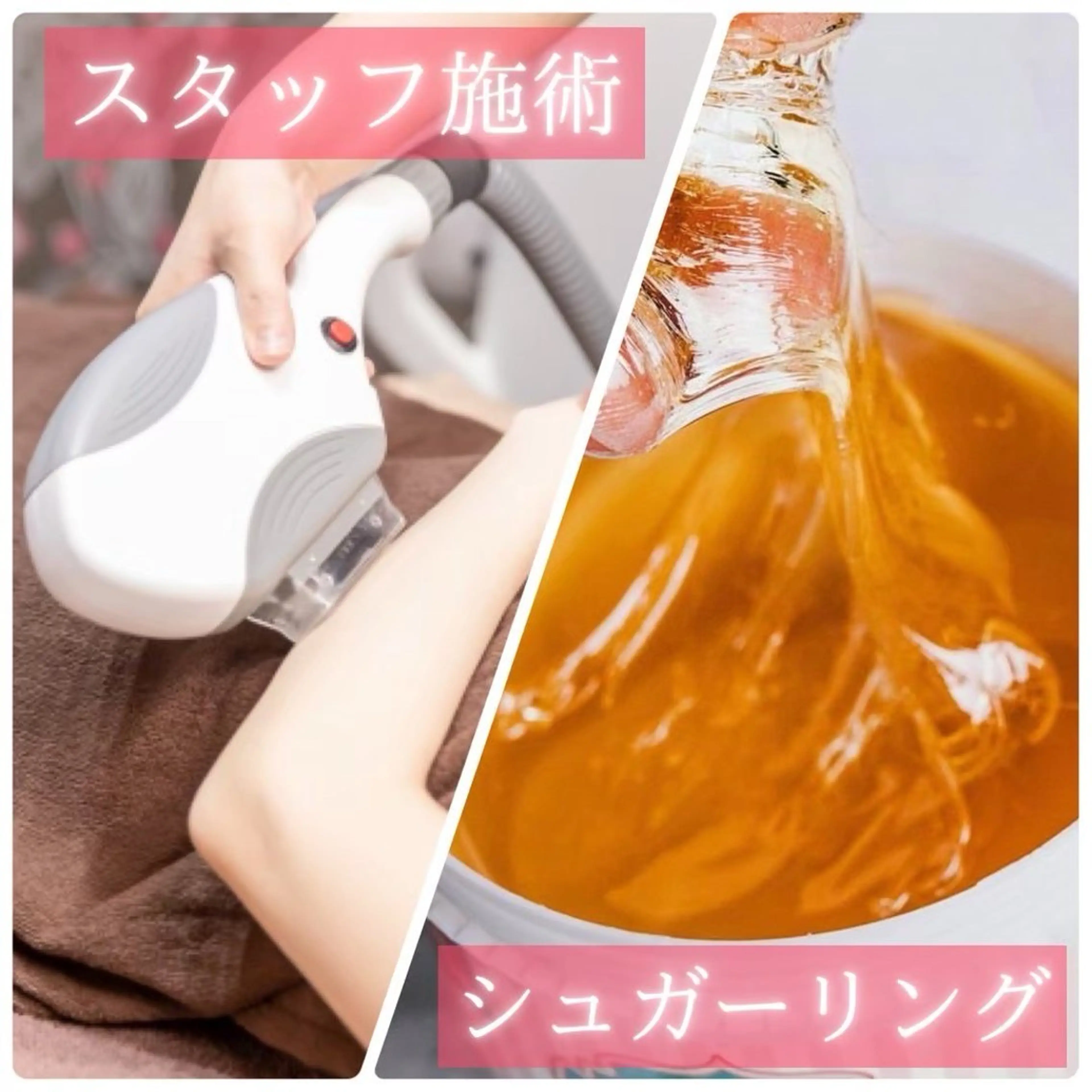 【同日施術★】フェイシャル　シュガーリング脱毛＋光脱毛　¥9980→¥7980の写真