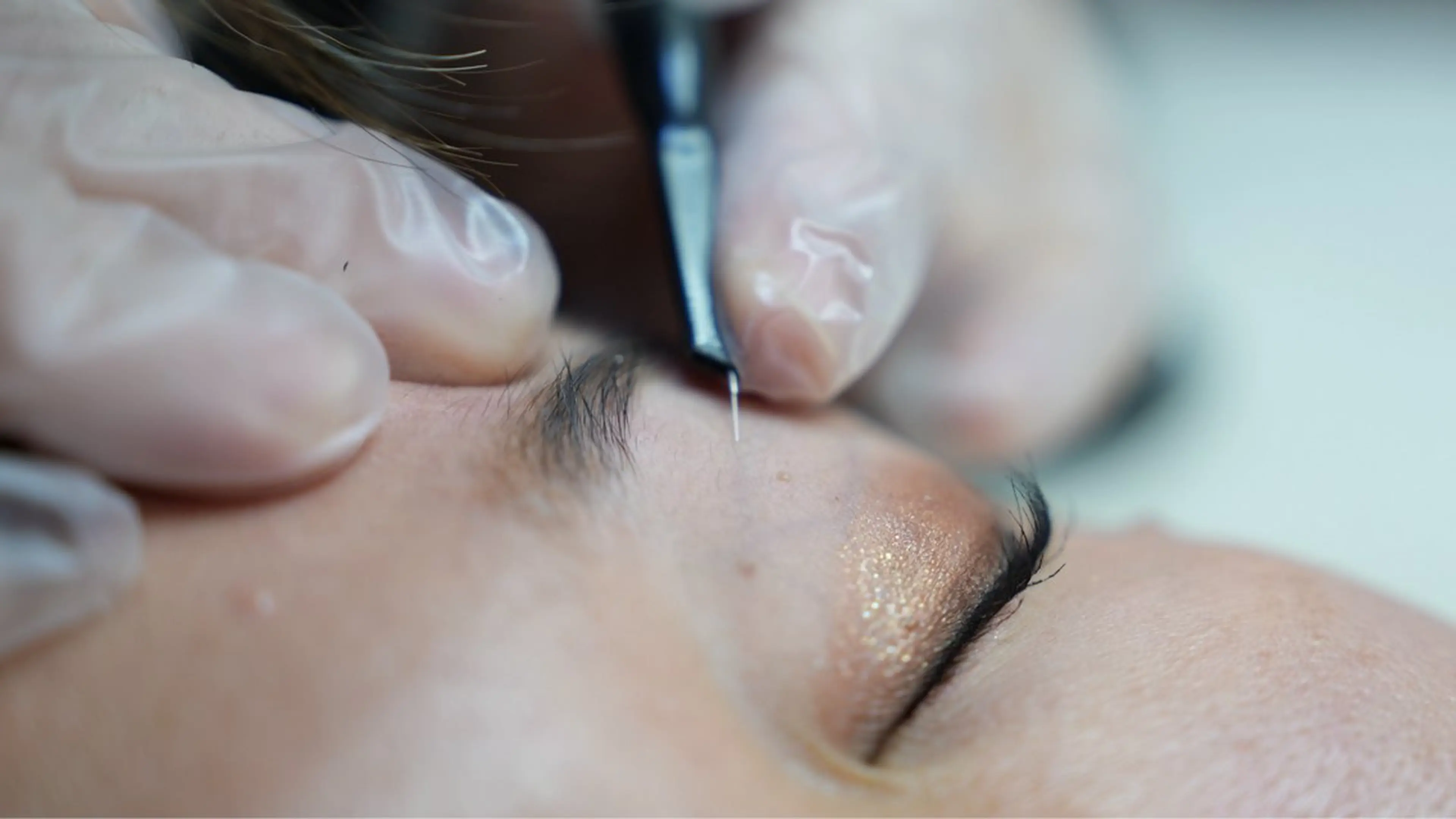 女性限定✨美容電気脱毛 VIO込みモニター✨25分＋冷却5分￥5000現金支払いのみの写真