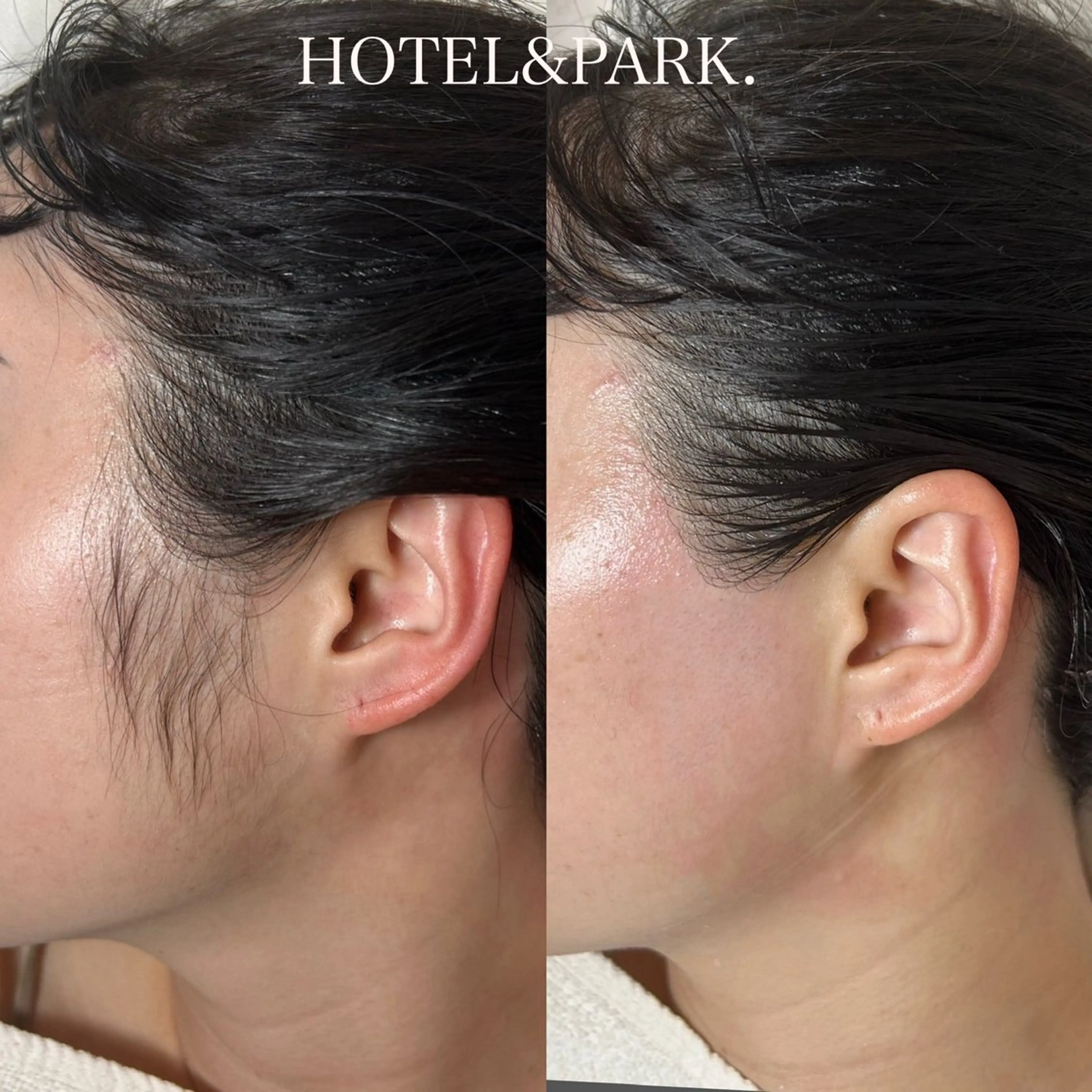 HOTEL&PARK .Moeワックス脱毛のエステ・リラクイメージ