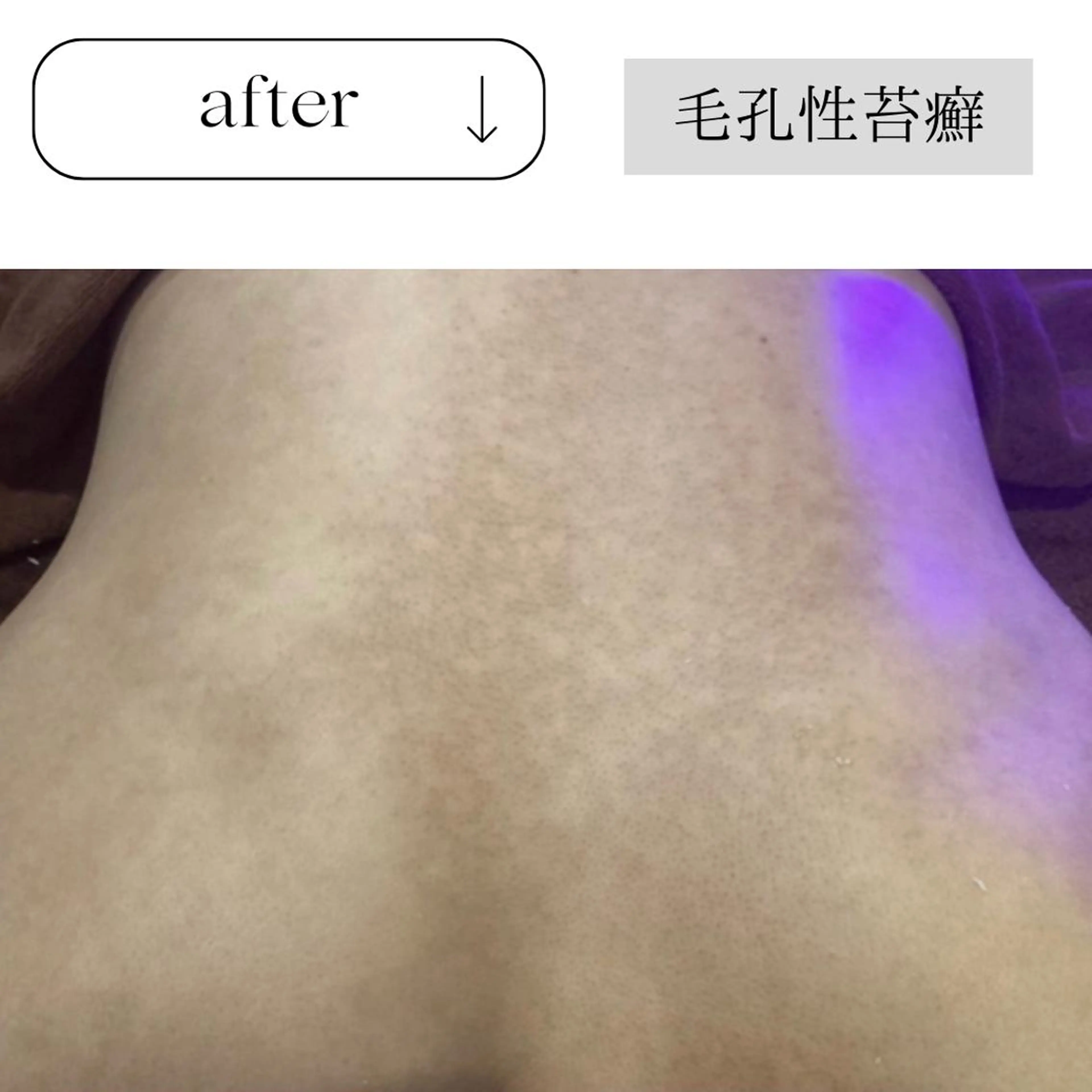 beauty CHOOSEのマツエク・マツパデザイン