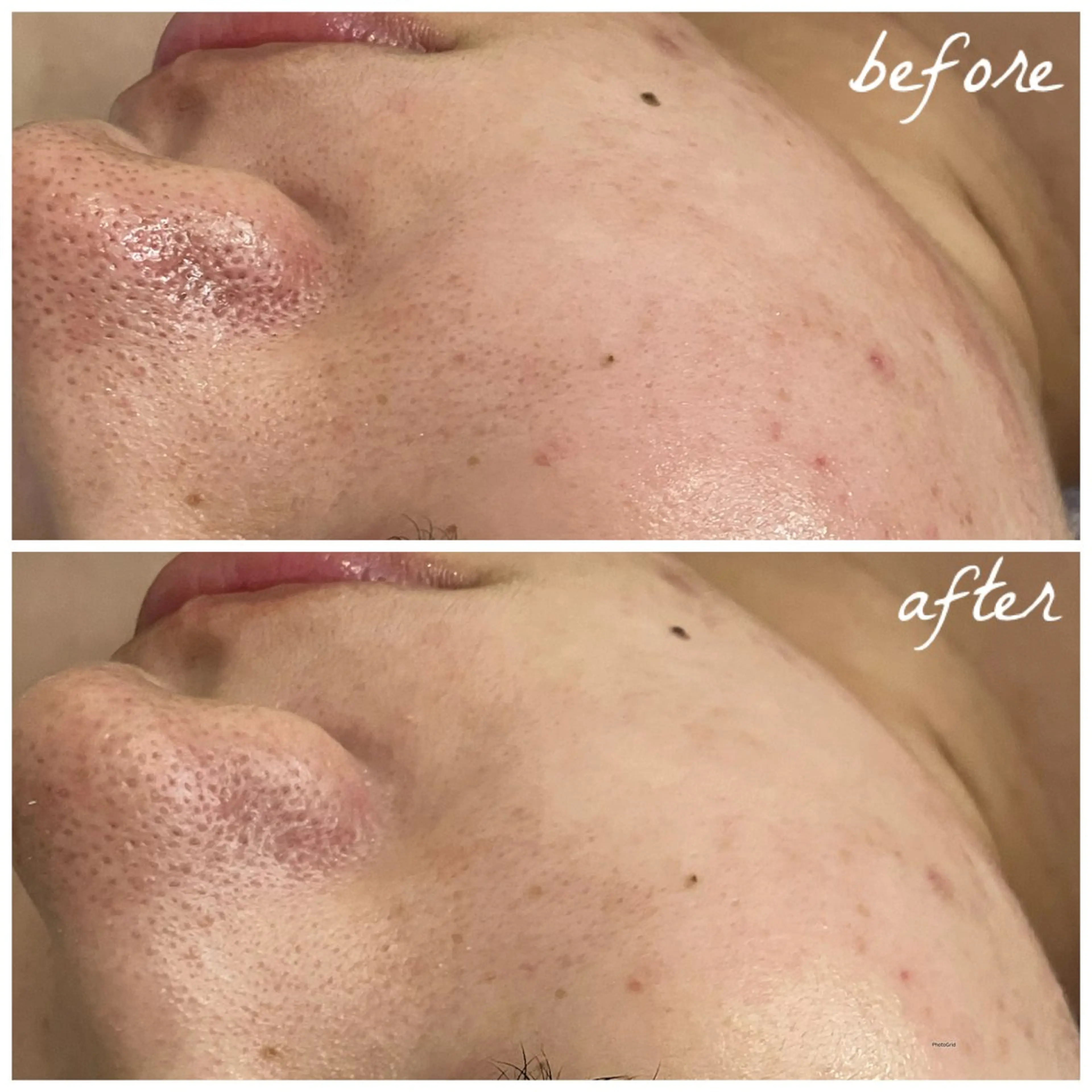 メンズ エステ メナード岐阜茜部 杉浦のエステ・リラクイメージ