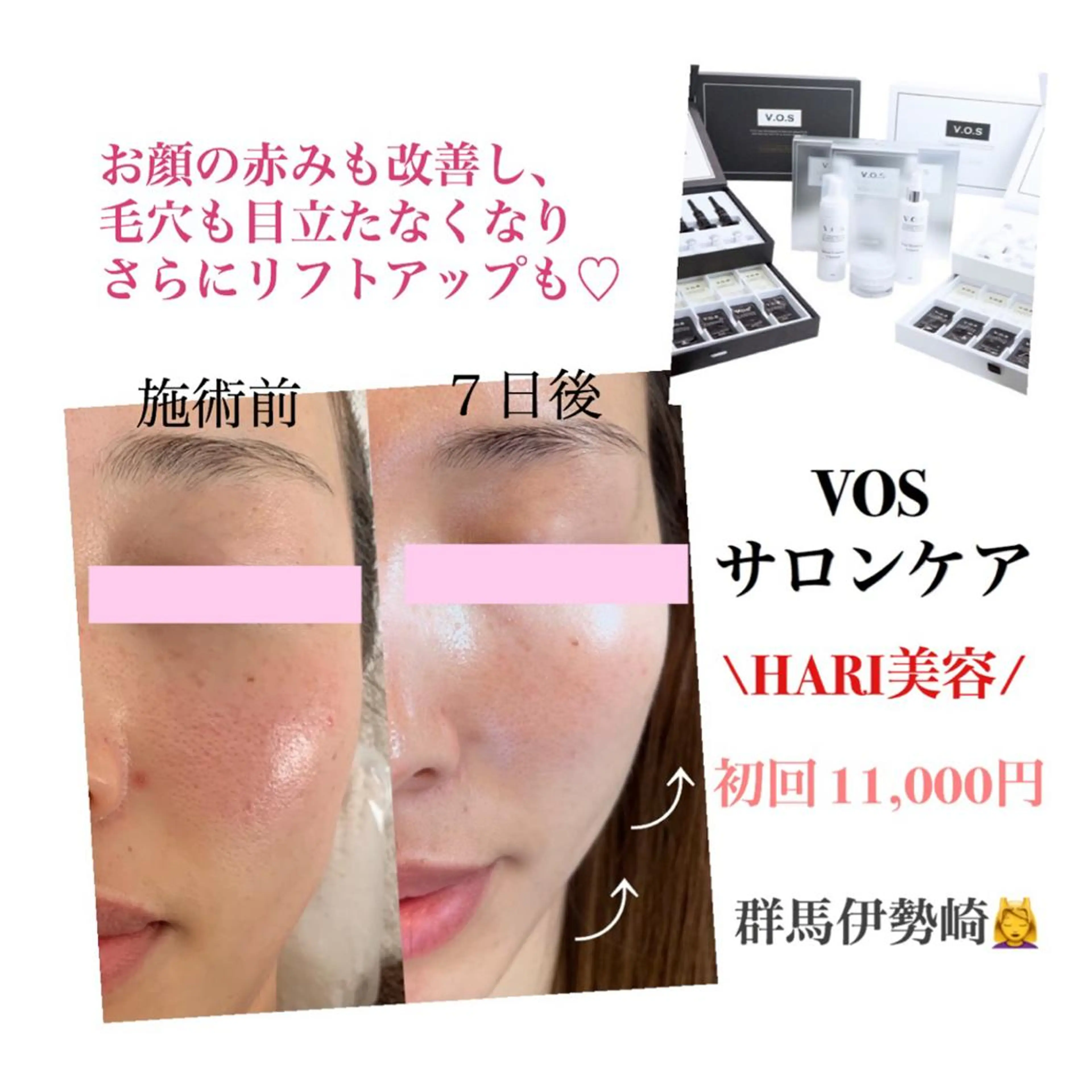 Ele'na eye beautyのマツエク・マツパデザイン