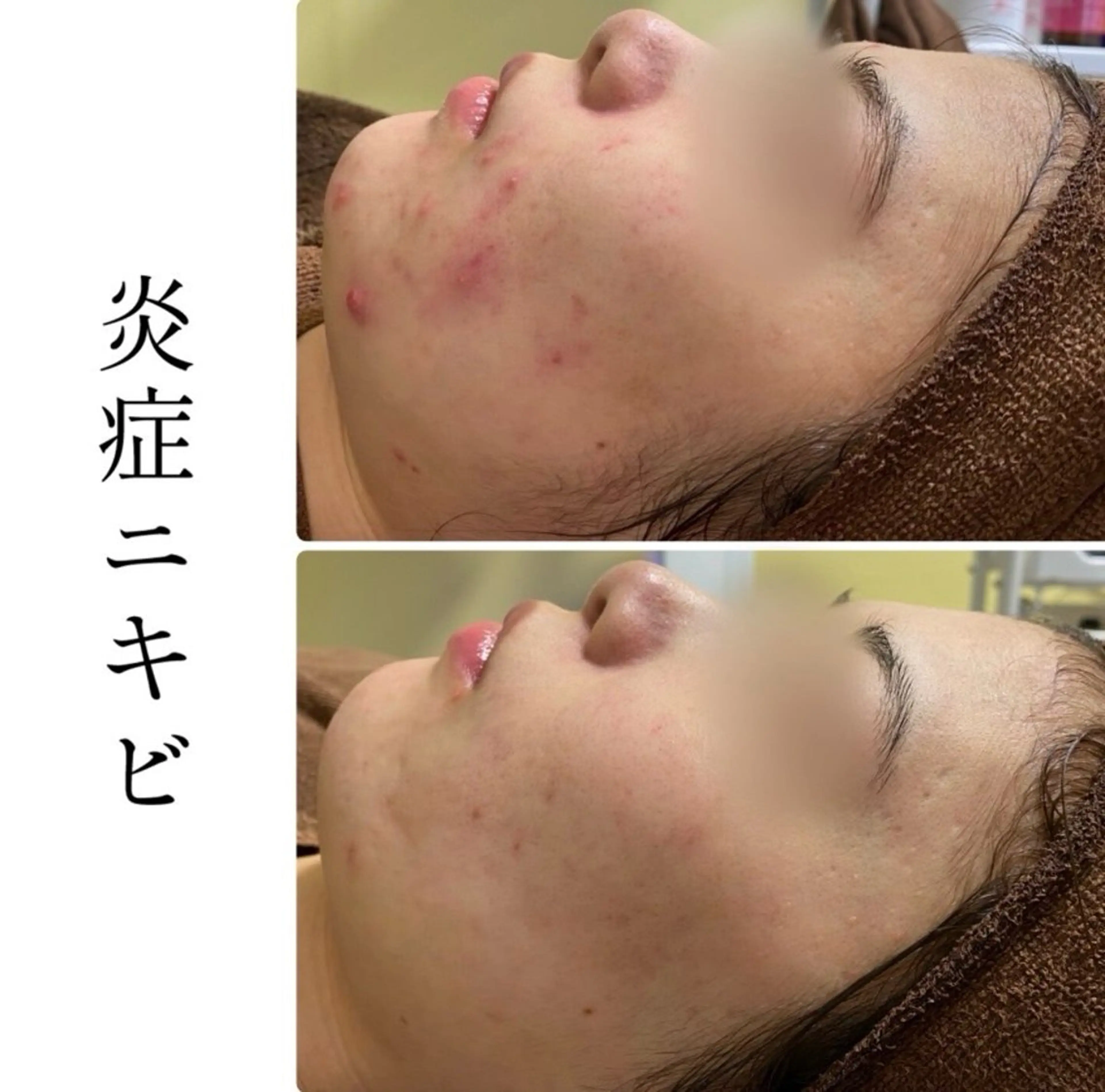 エステ ハーブピーリング専門 BIOPLUS＋川崎のエステ・リラクイメージ