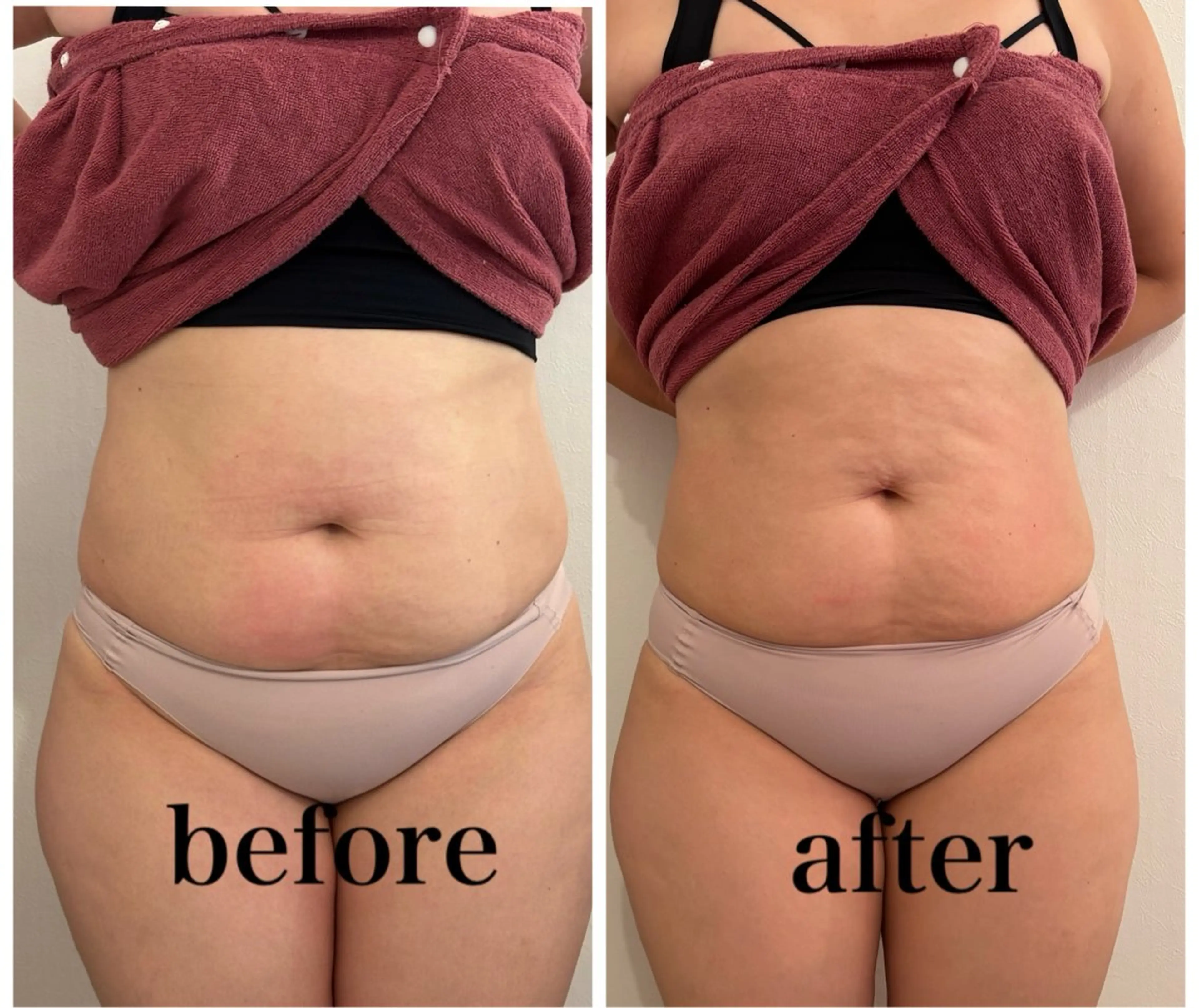 その他 腸活サポート みなみののエステ・リラクイメージ