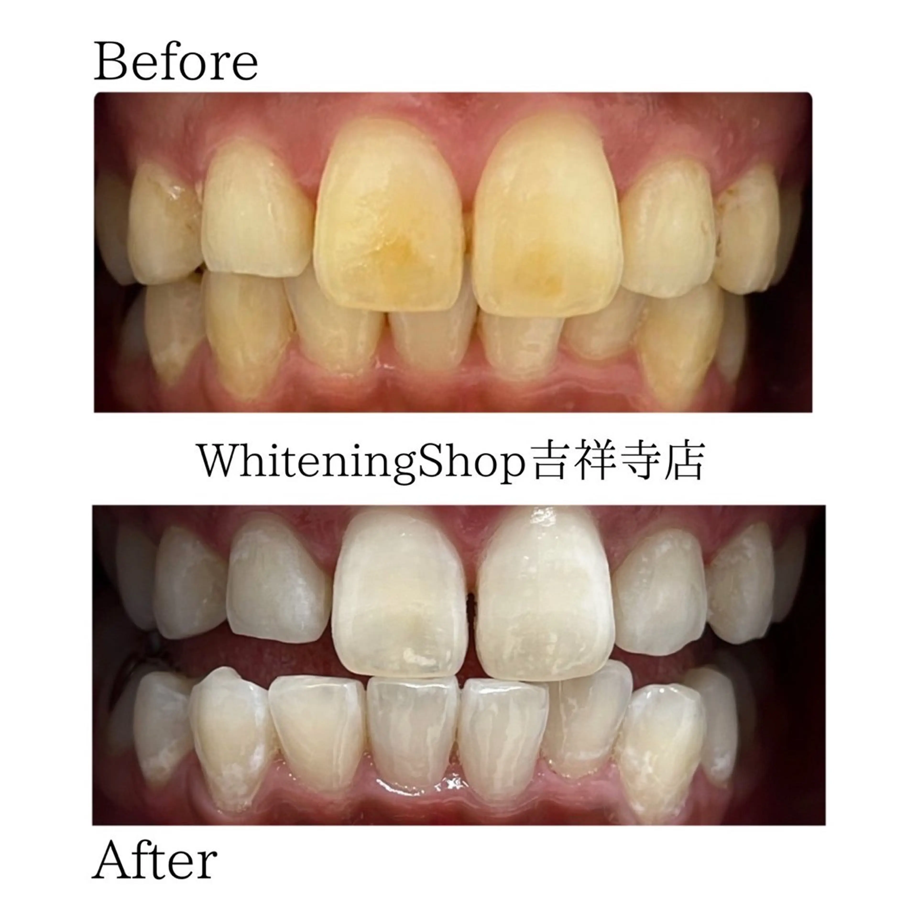 エステ リラク ホワイトニング ショップ吉祥寺店のエステ・リラクイメージ