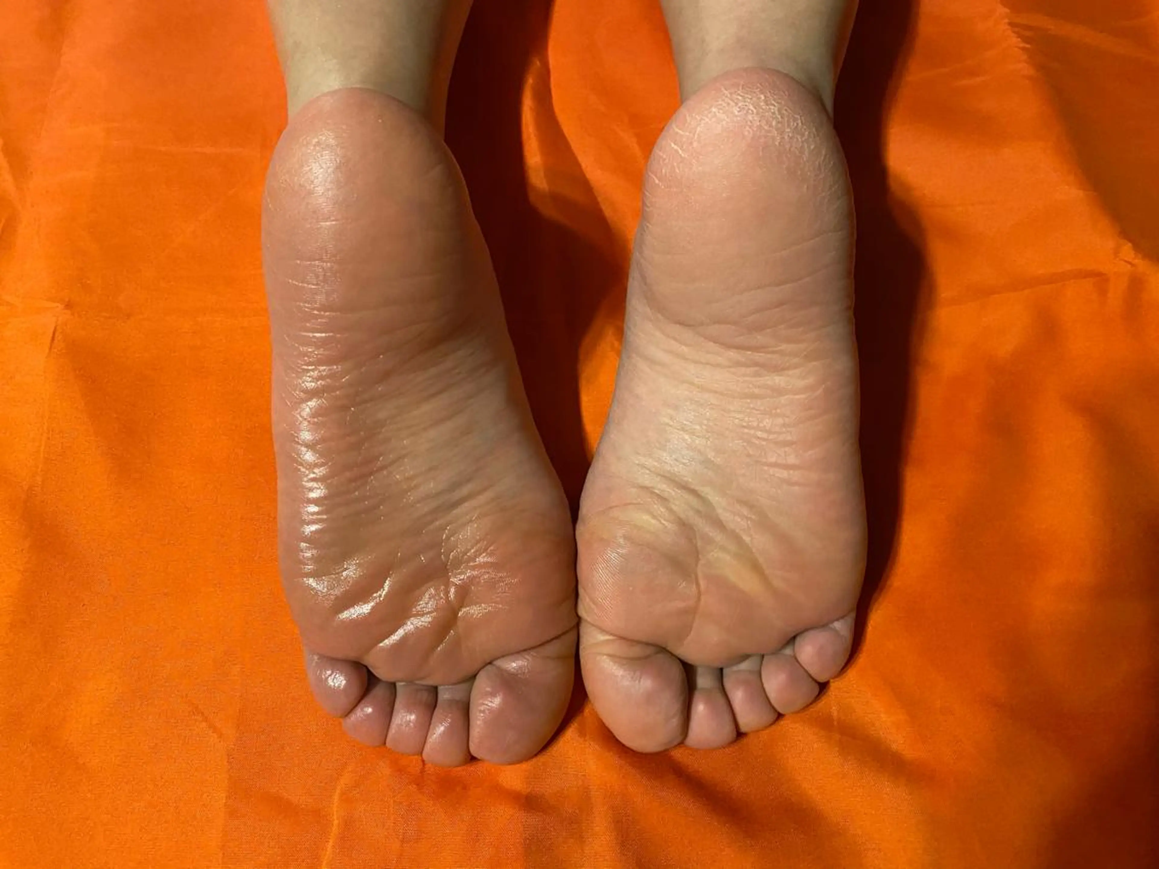 Mandarin Orange所属・毛穴から始める肌メン テマンダリンオレンジのエステ・リラクイメージ