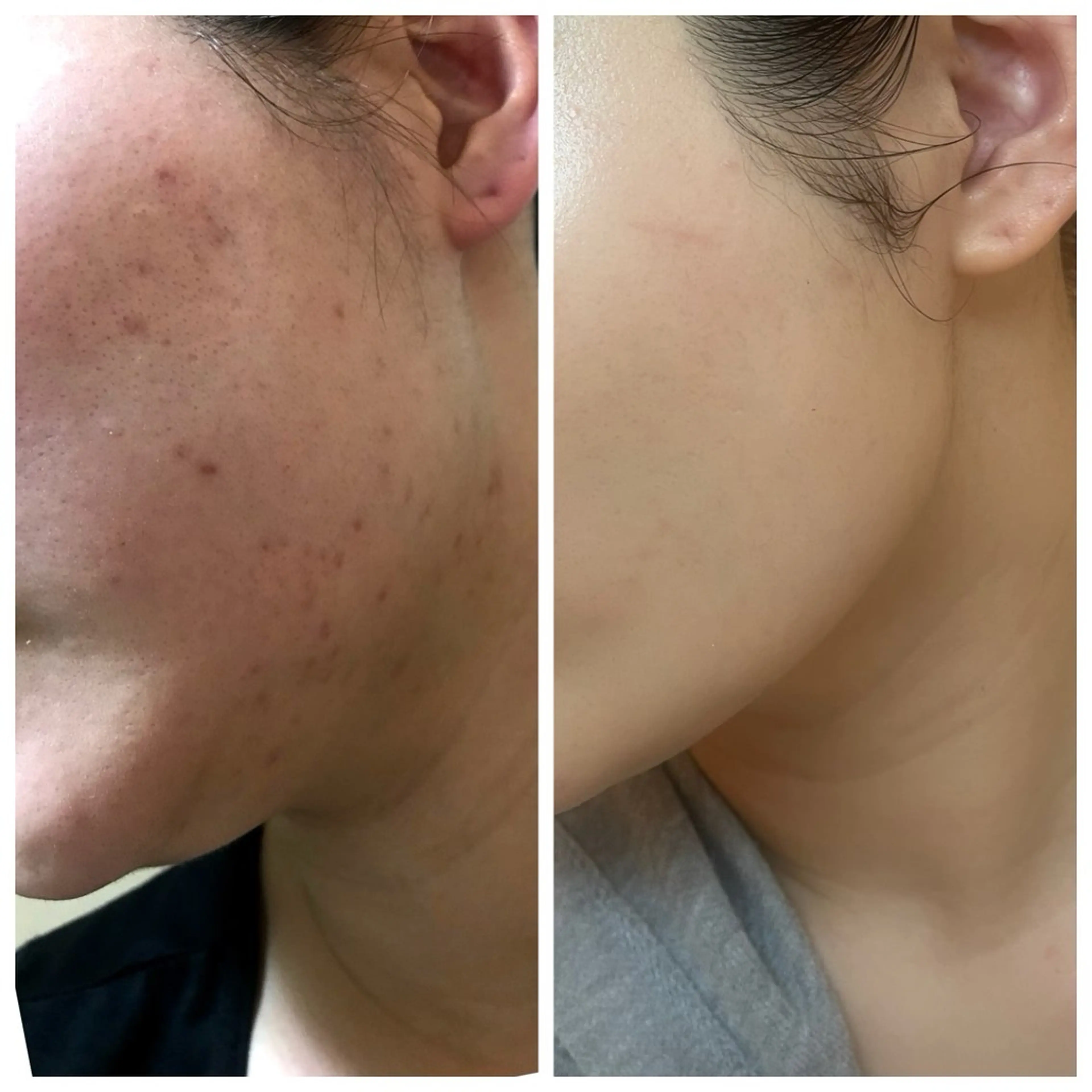 エステ LIAN  Beauty Salon所属・LIAN リアンのエステ・リラクイメージ