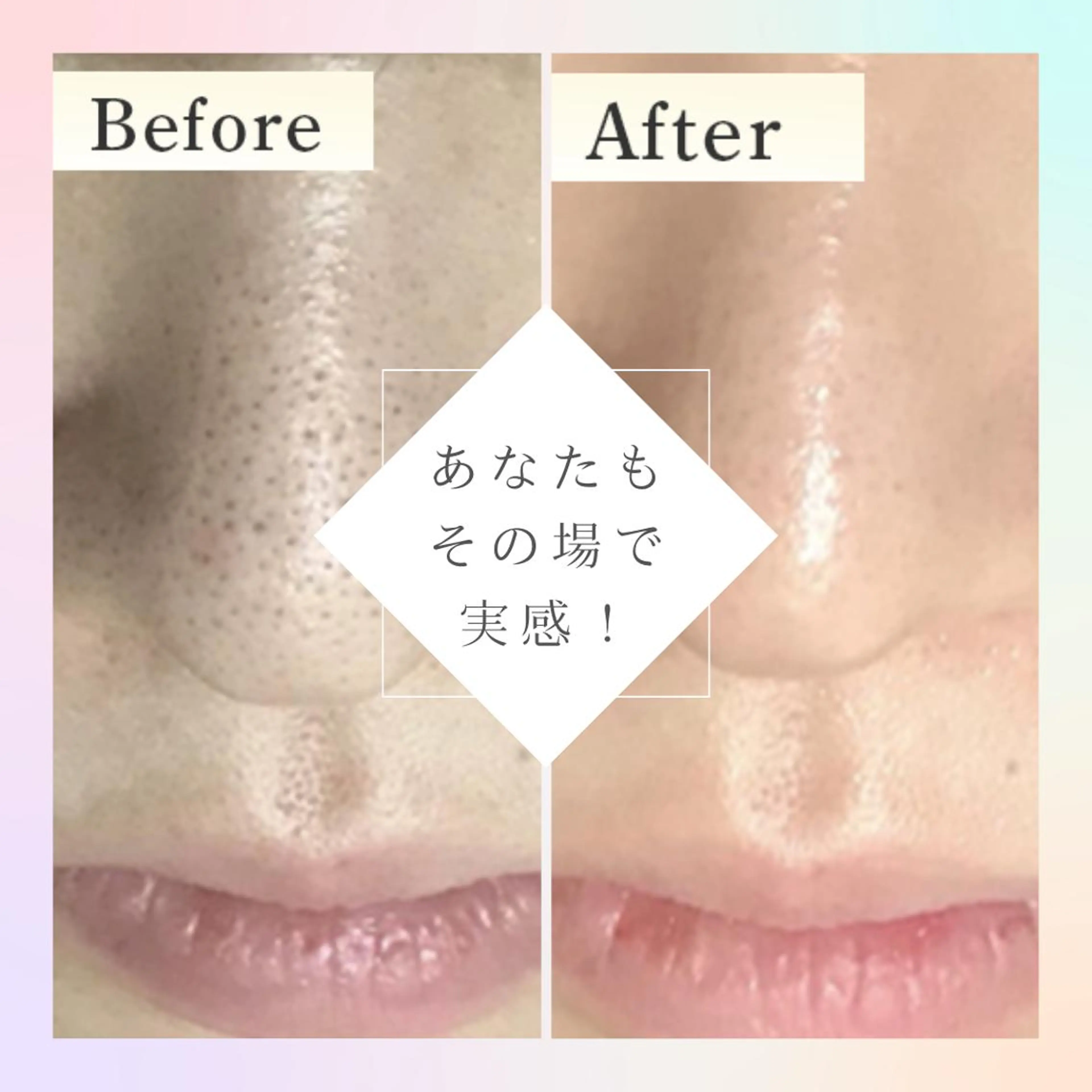 毛穴専門店Bebe 蘭のエステ・リラクイメージ