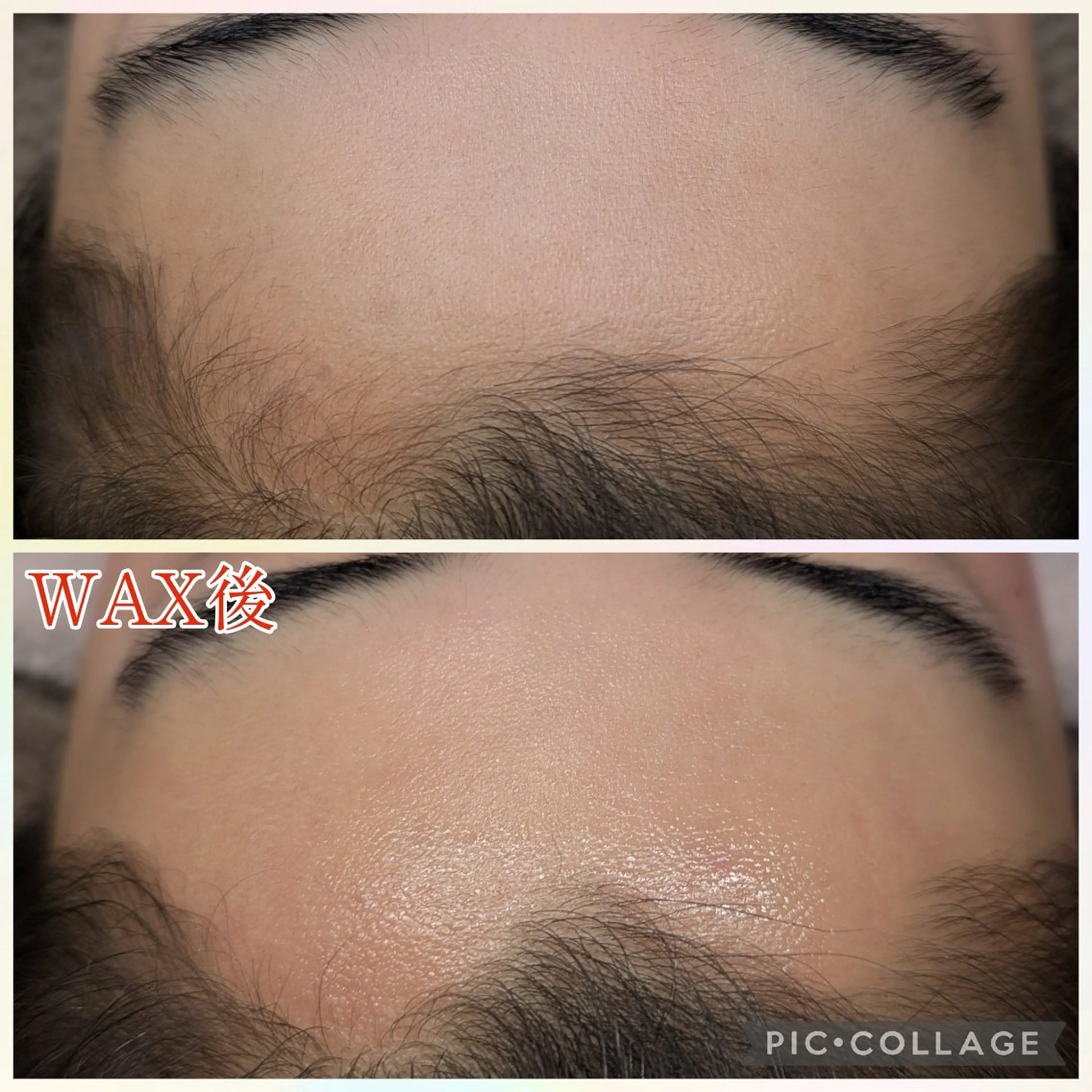 脱毛 肌質改善プライベートサロンwith U所属・肌質改善サロン with Uのエステ・リラクイメージ