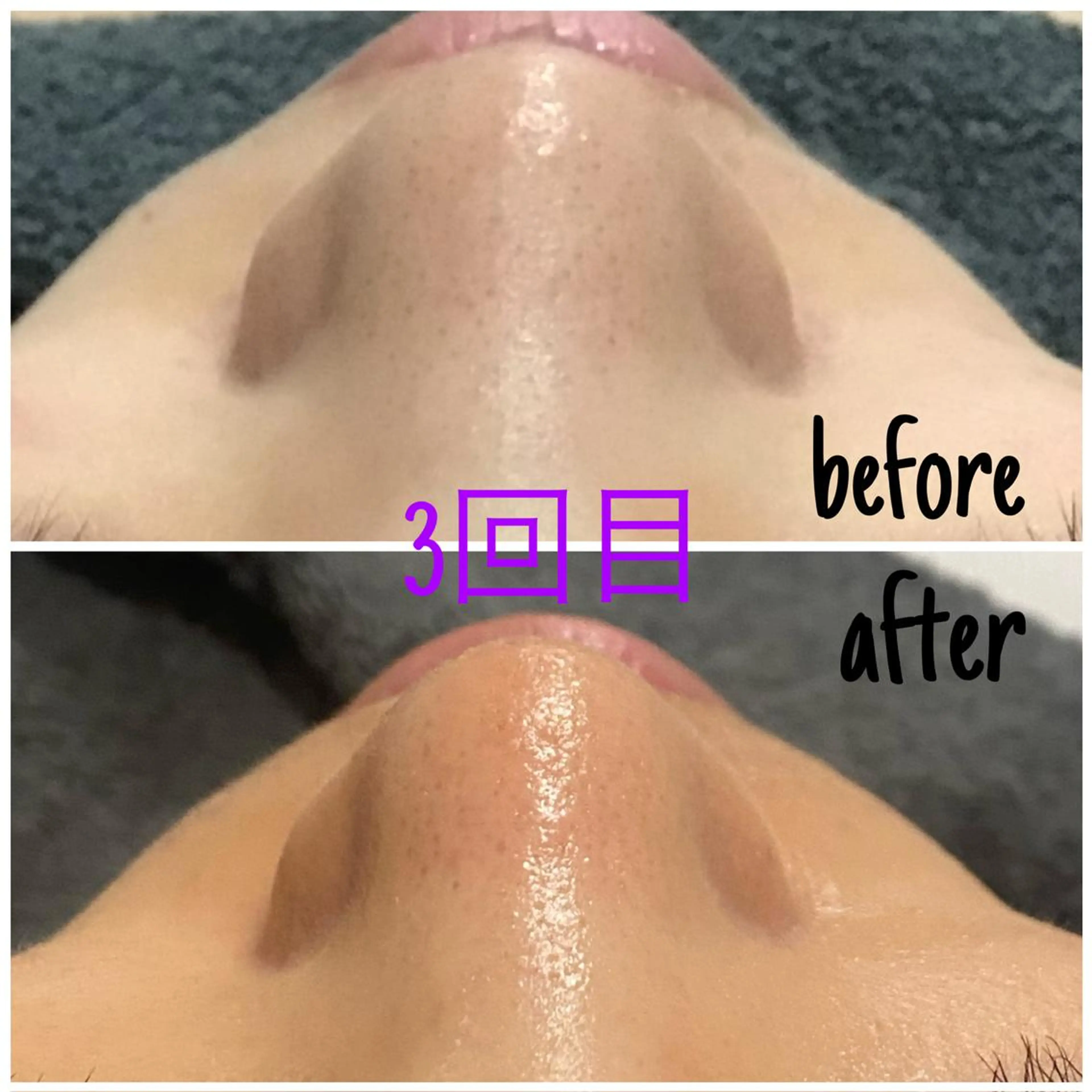 アルカンジュ~archange~所属・痩身/毛穴洗浄/脱毛 アルカンジュのエステ・リラクイメージ