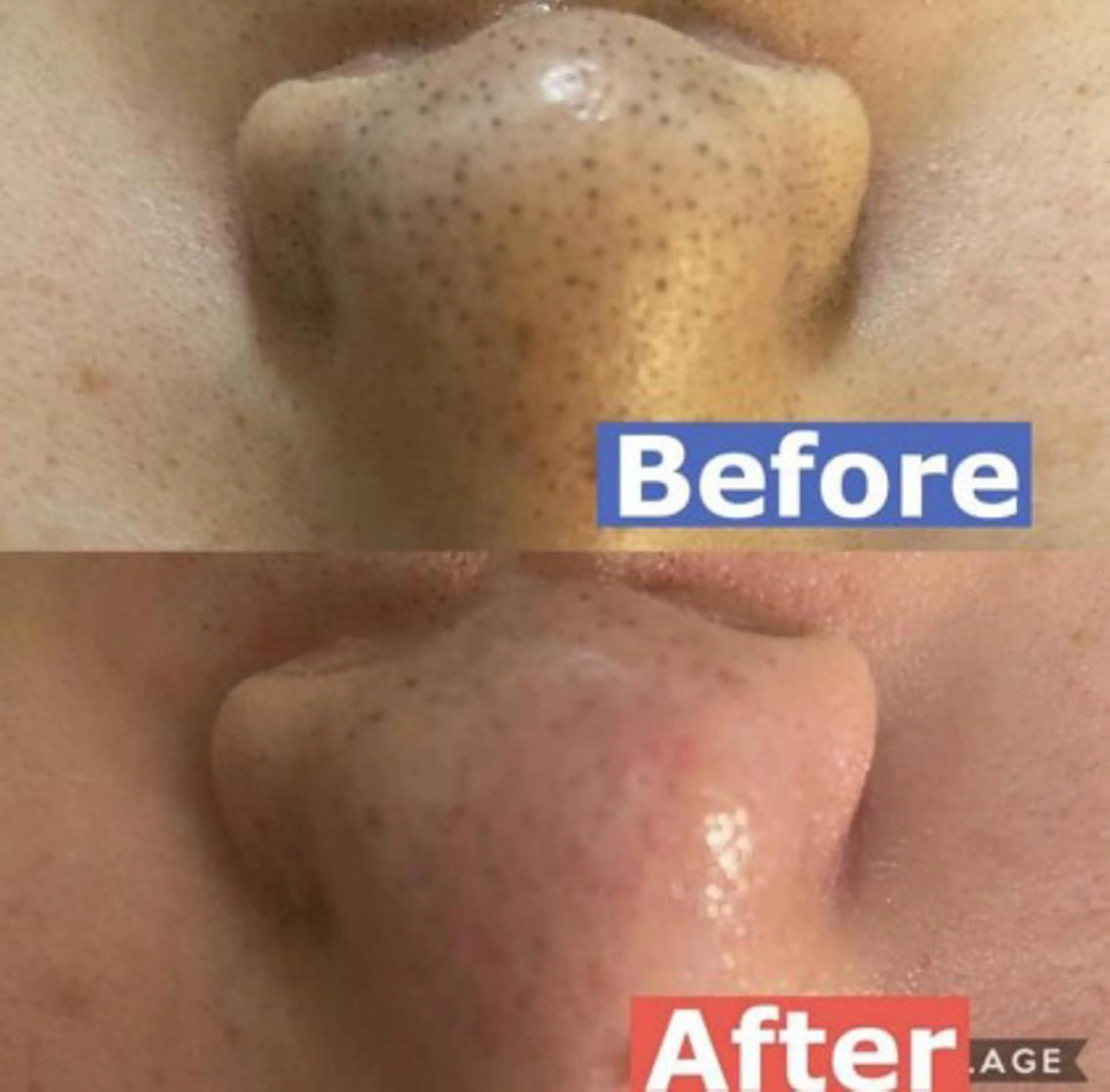 🥀エステティック レイビス横浜　永🥀のエステ・リラクイメージ