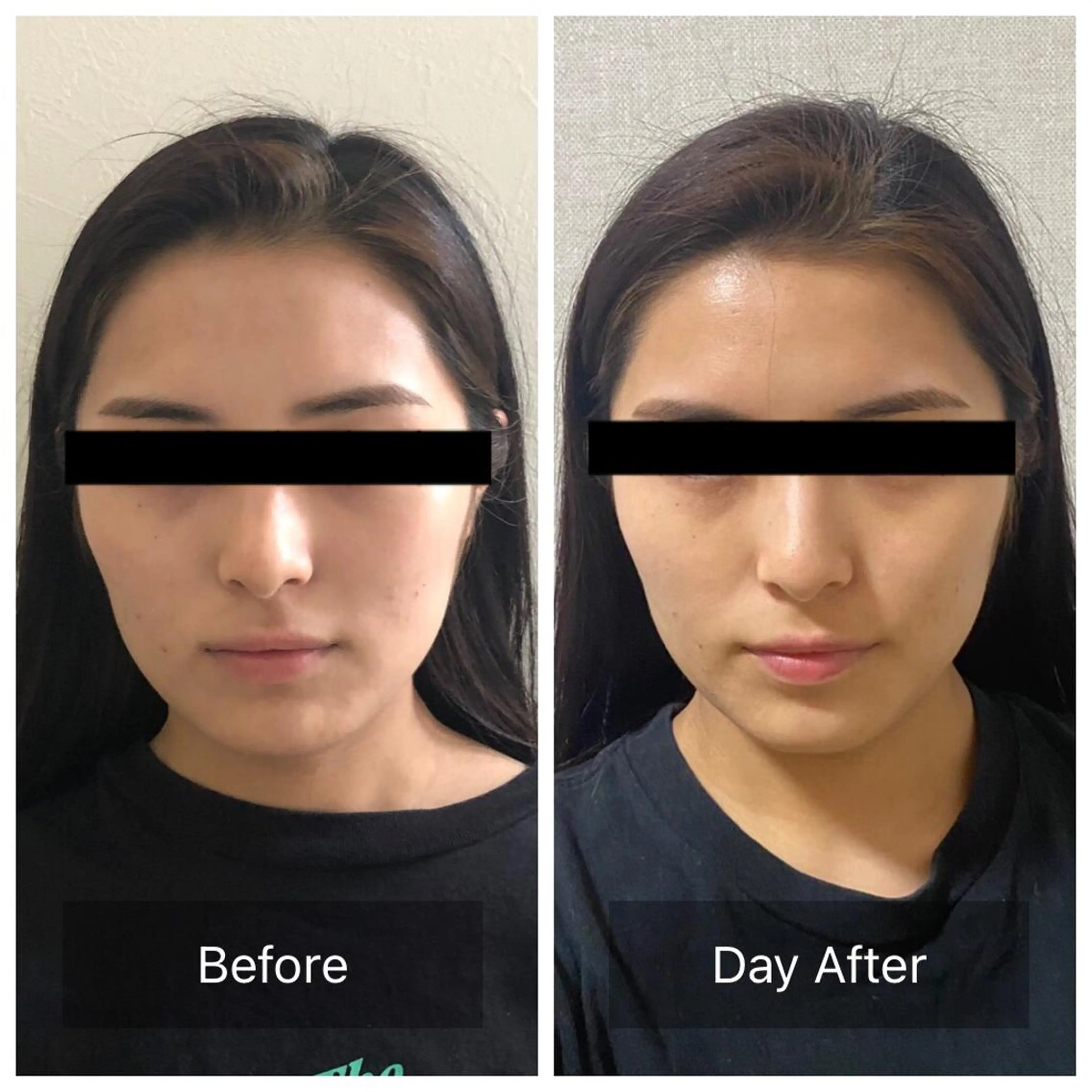 Radiance H.Oのエステ・リラクイメージ