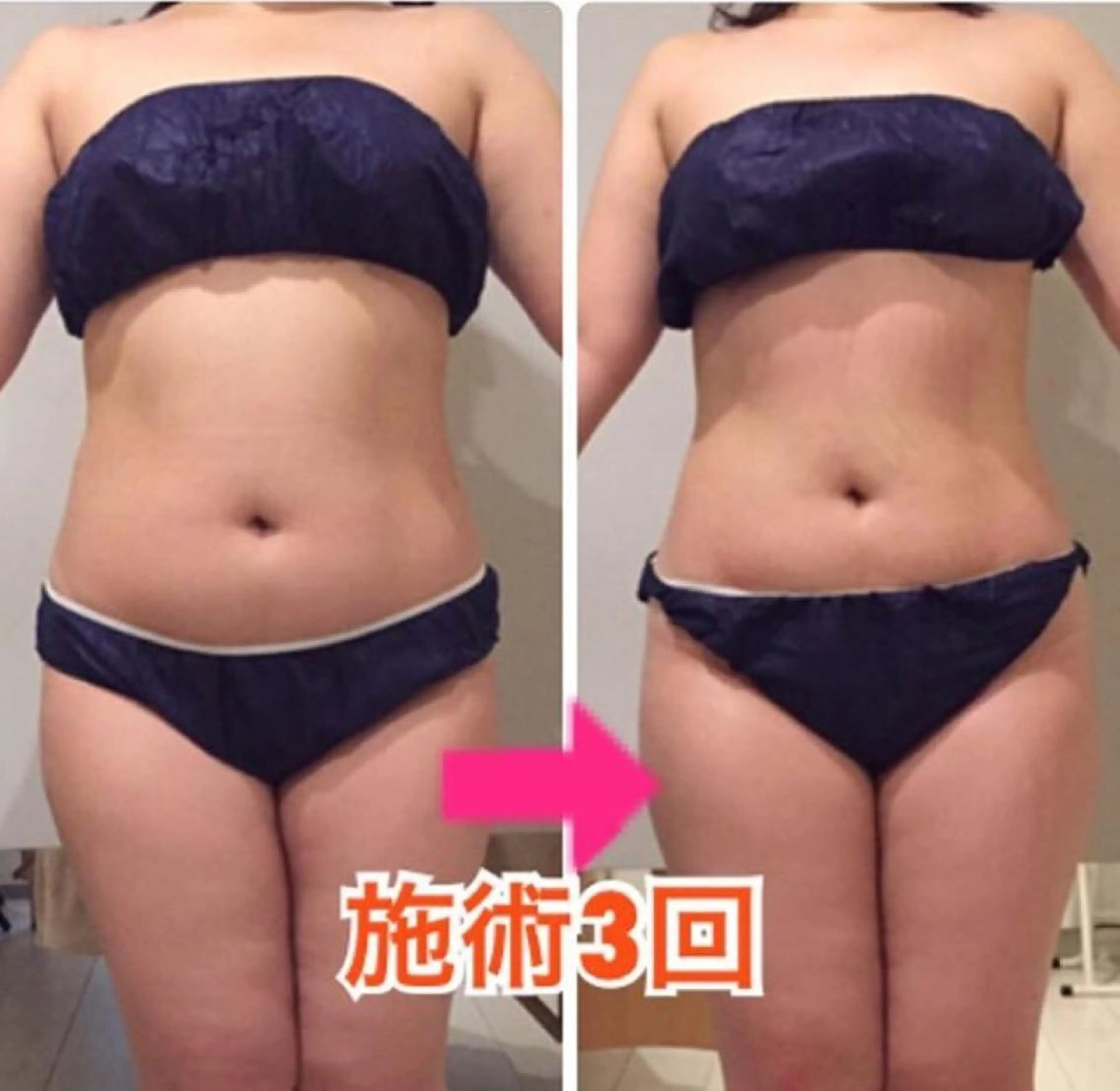 ロング カラー パーマ ヘアアレンジ メンズ キッズ ネイル マツエク・マツパ マットネイル ‍痩身＆ボディ 結果出し🌟丹野のエステ・リラクイメージ